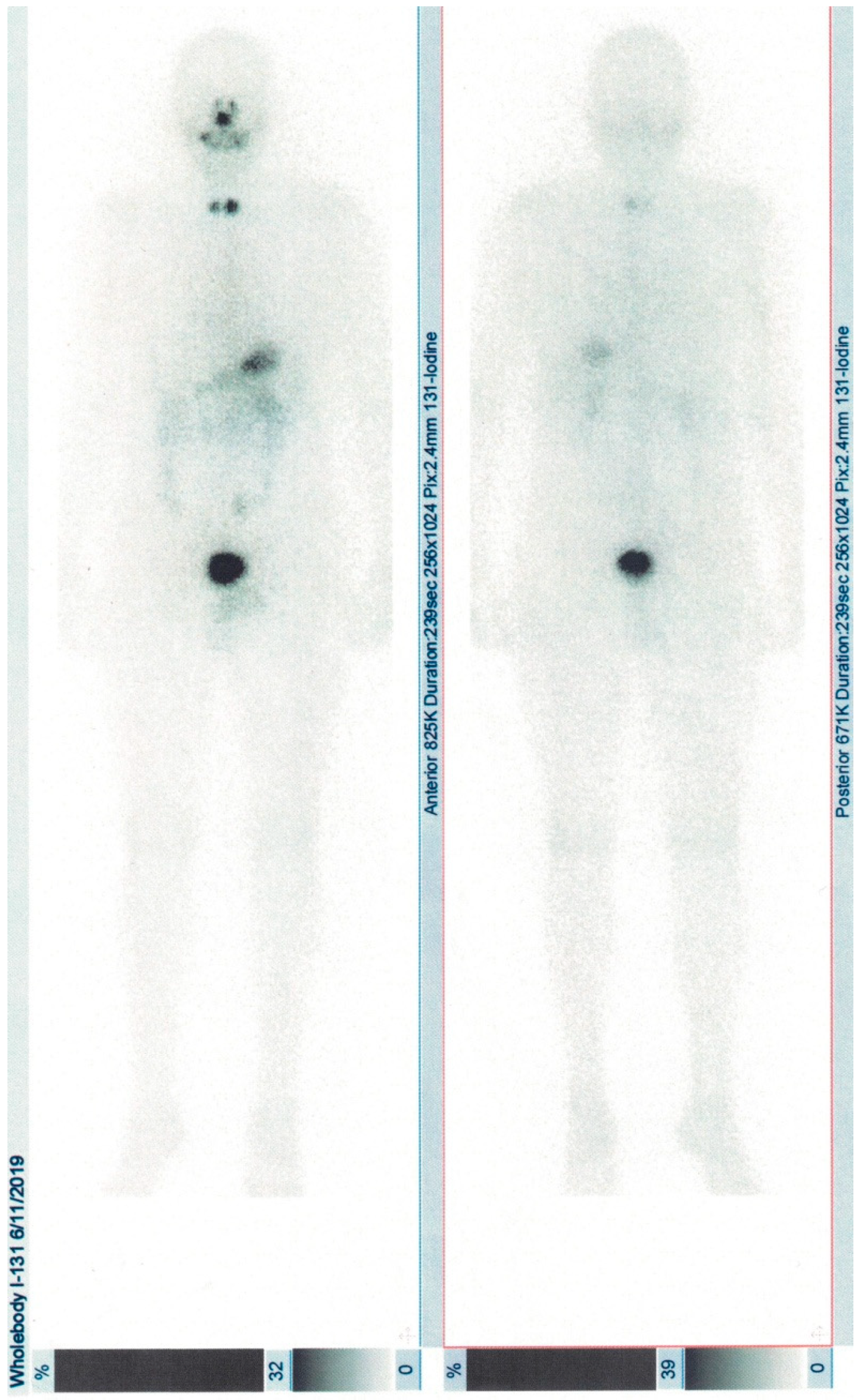 Diagnostics 10 00316 g002