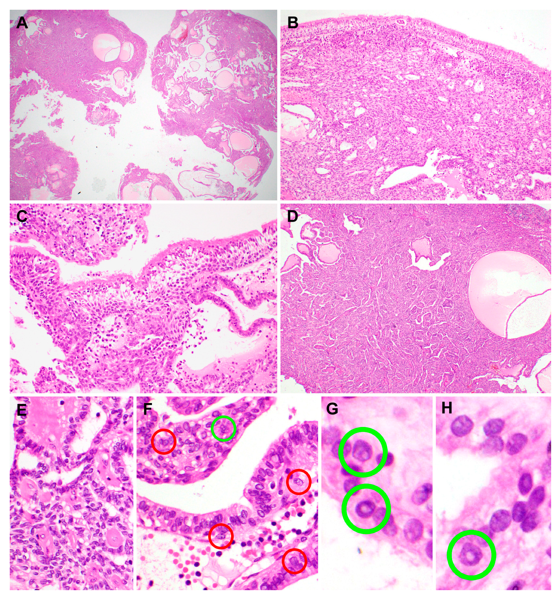 Diagnostics 10 00323 g002 Diagnostics 10 00323 g002