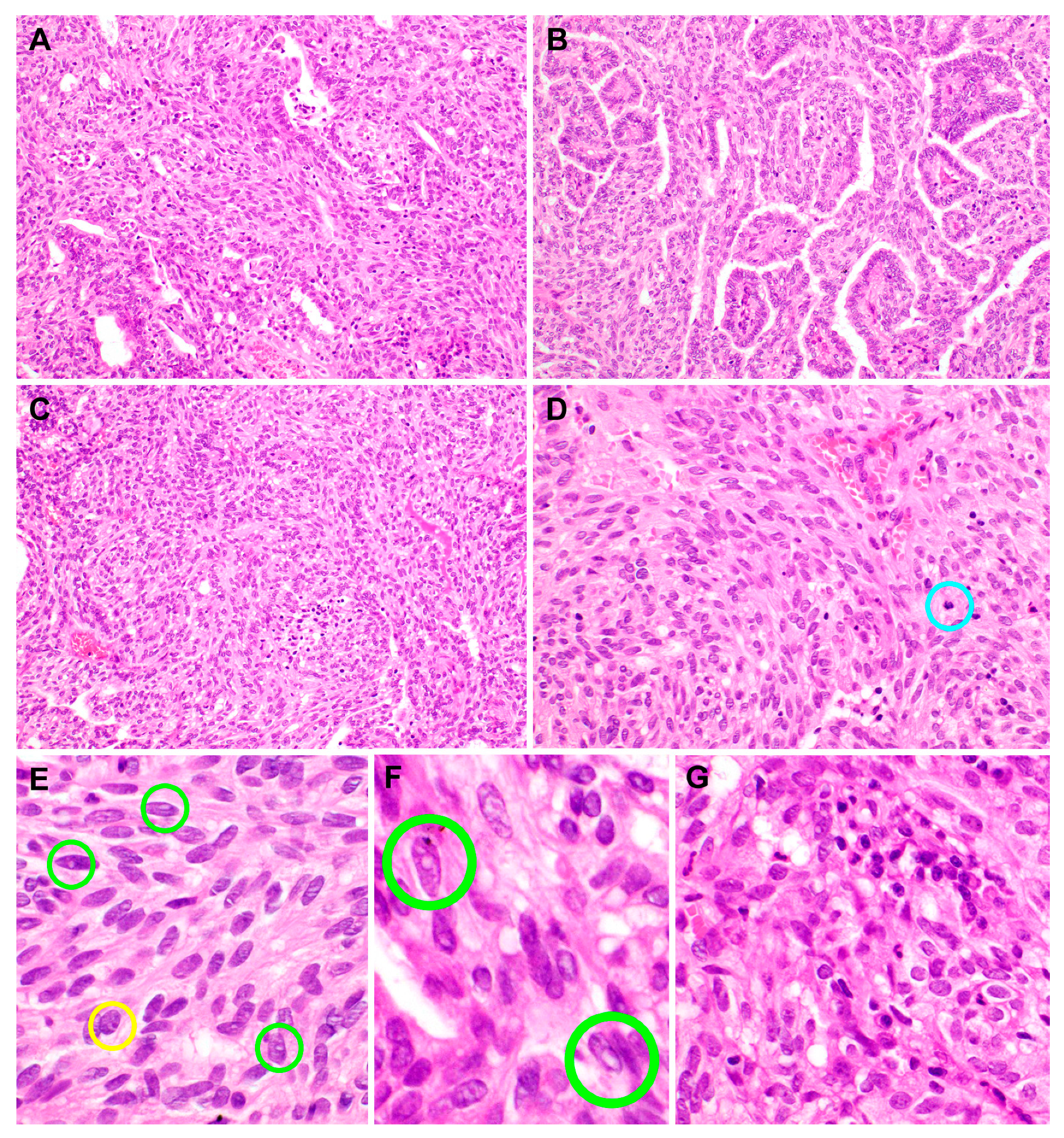 Diagnostics 10 00323 g003 Diagnostics 10 00323 g003