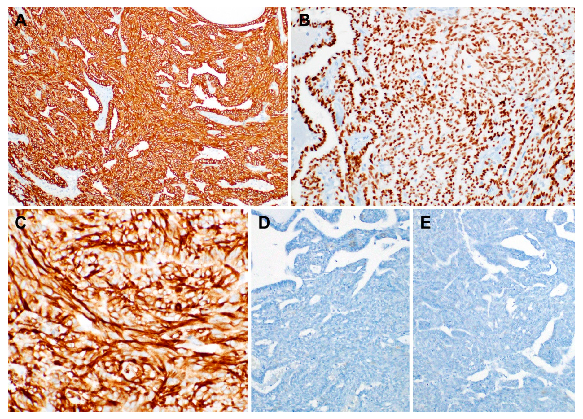 Diagnostics 10 00323 g004 Diagnostics 10 00323 g004