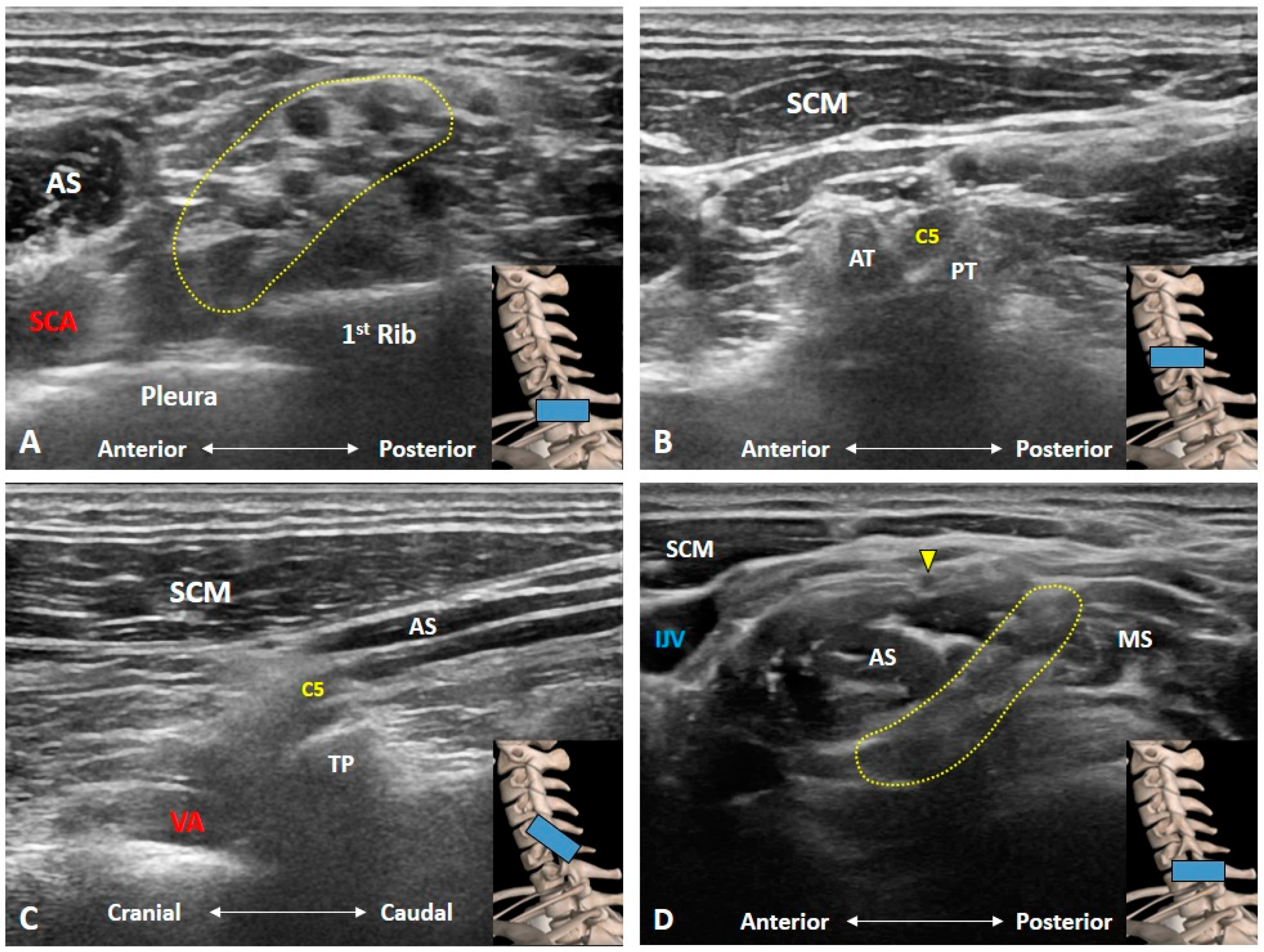 Diagnostics 10 00324 g002 Diagnostics 10 00324 g002