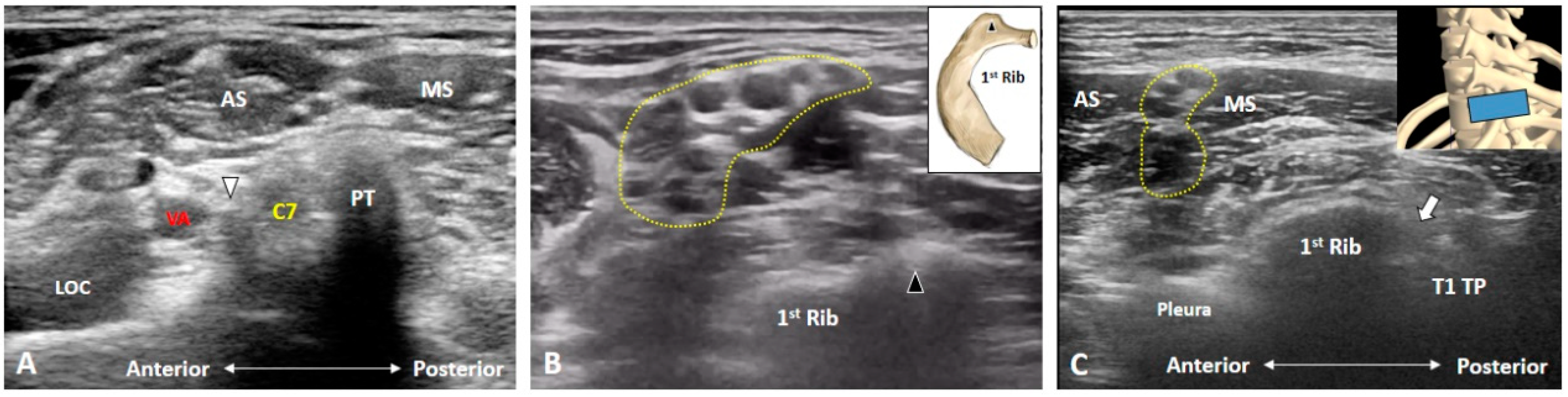 Diagnostics 10 00324 g003 Diagnostics 10 00324 g003