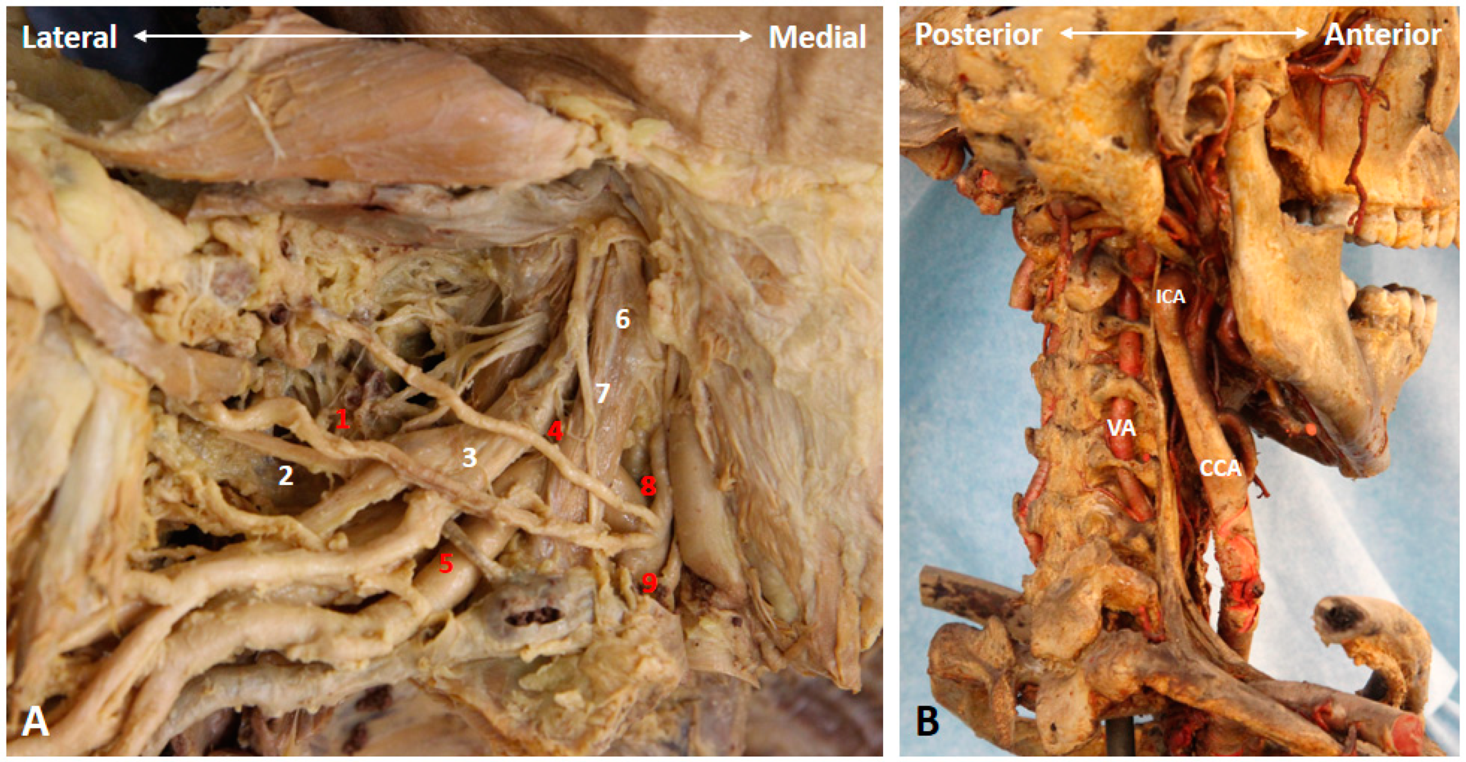 Diagnostics 10 00324 g006 Diagnostics 10 00324 g006