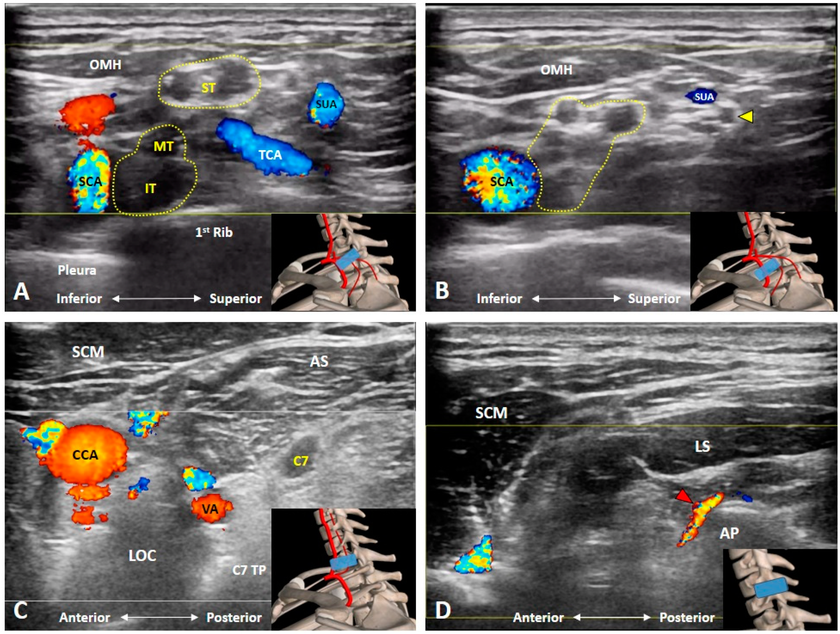 Diagnostics 10 00324 g007 Diagnostics 10 00324 g007