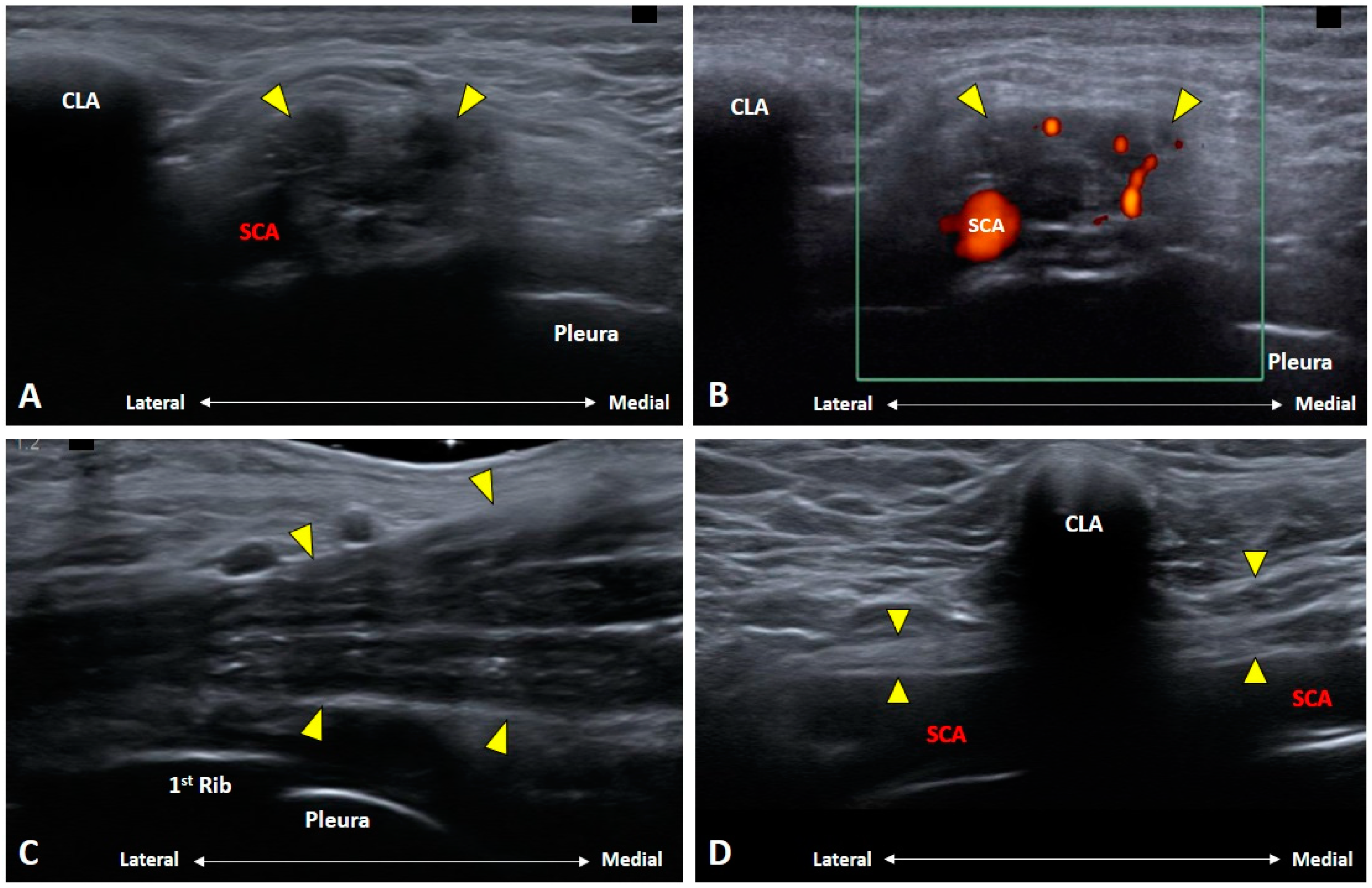 Diagnostics 10 00324 g012 Diagnostics 10 00324 g012