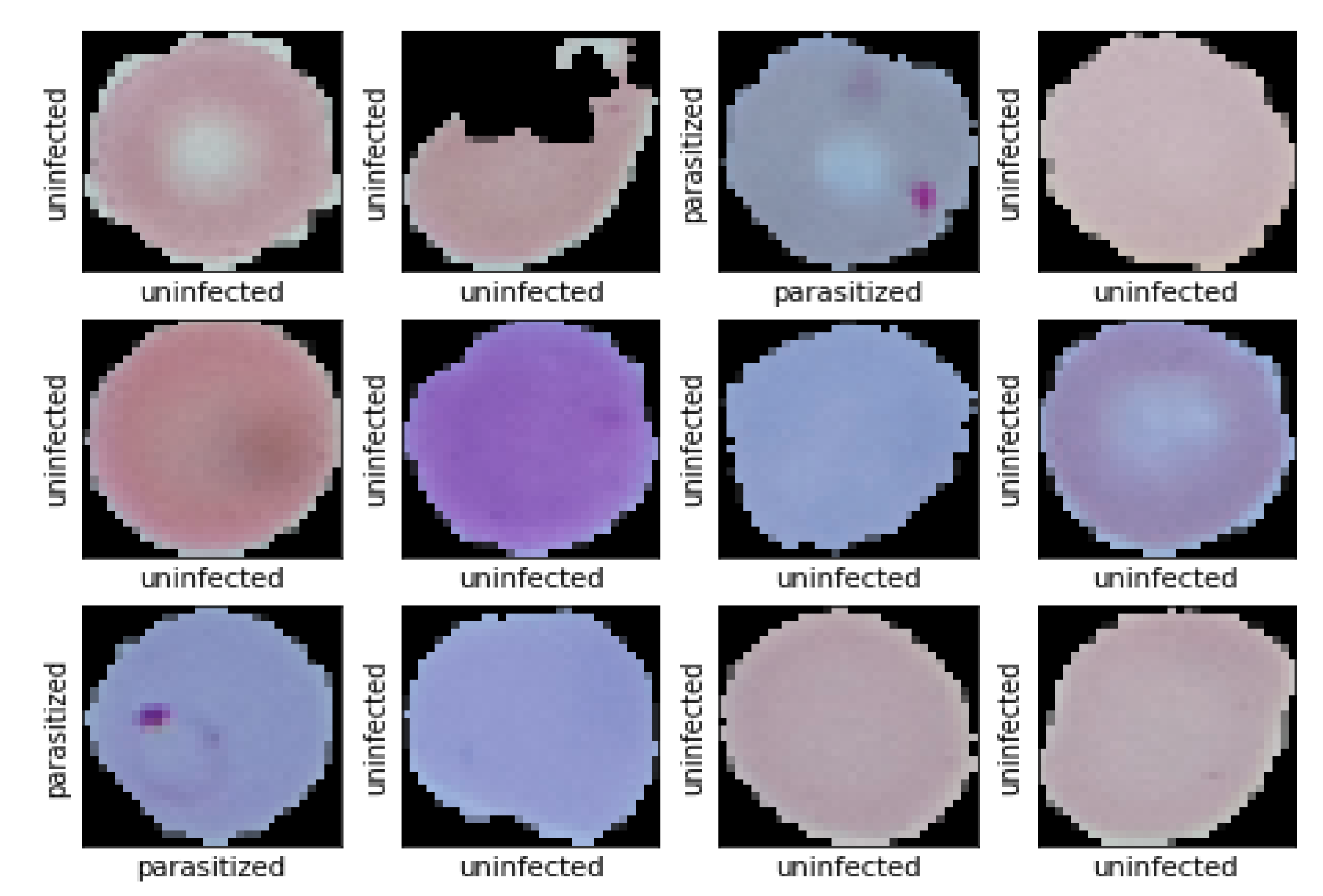 Diagnostics 10 00329 g012
