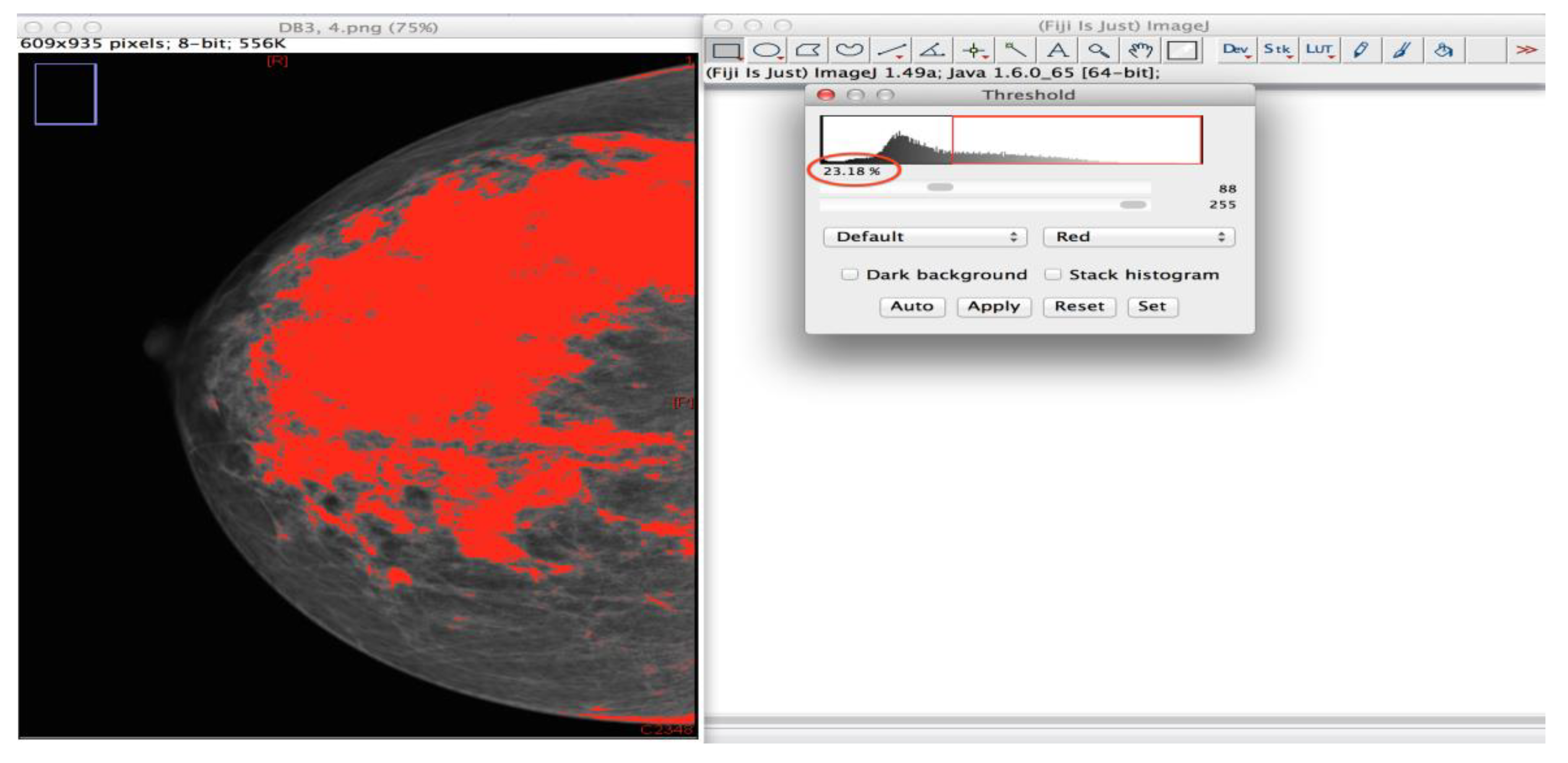 Diagnostics 10 00331 g002 Diagnostics 10 00331 g002