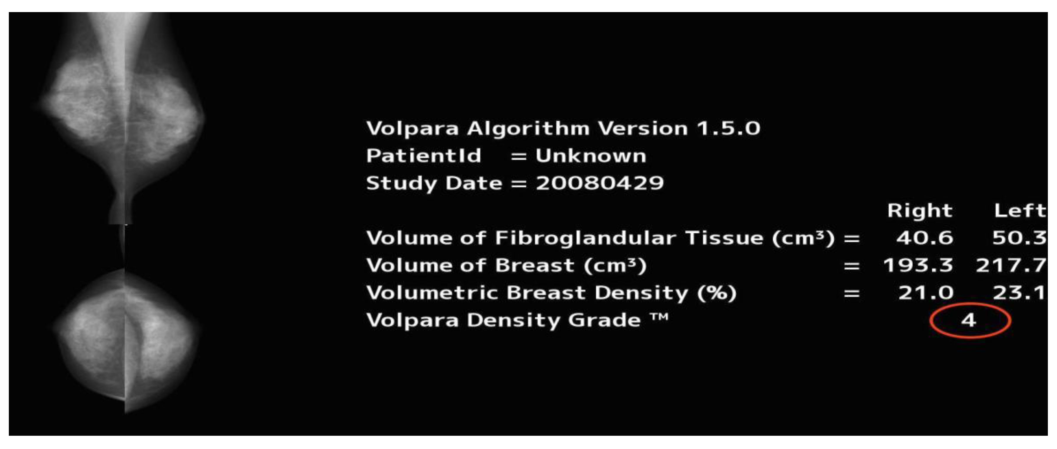 Diagnostics 10 00331 g003 Diagnostics 10 00331 g003