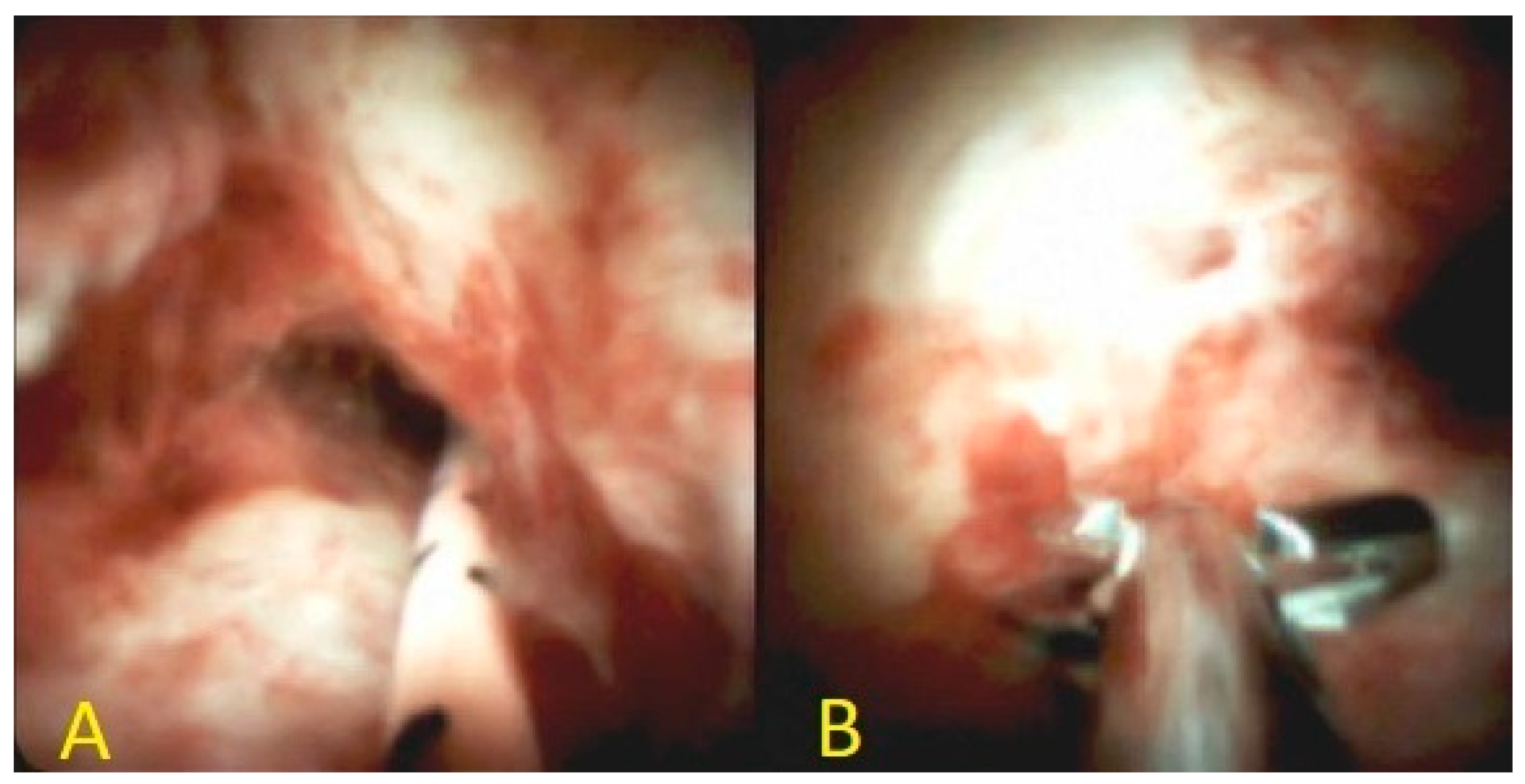 Diagnostics 10 00337 g007