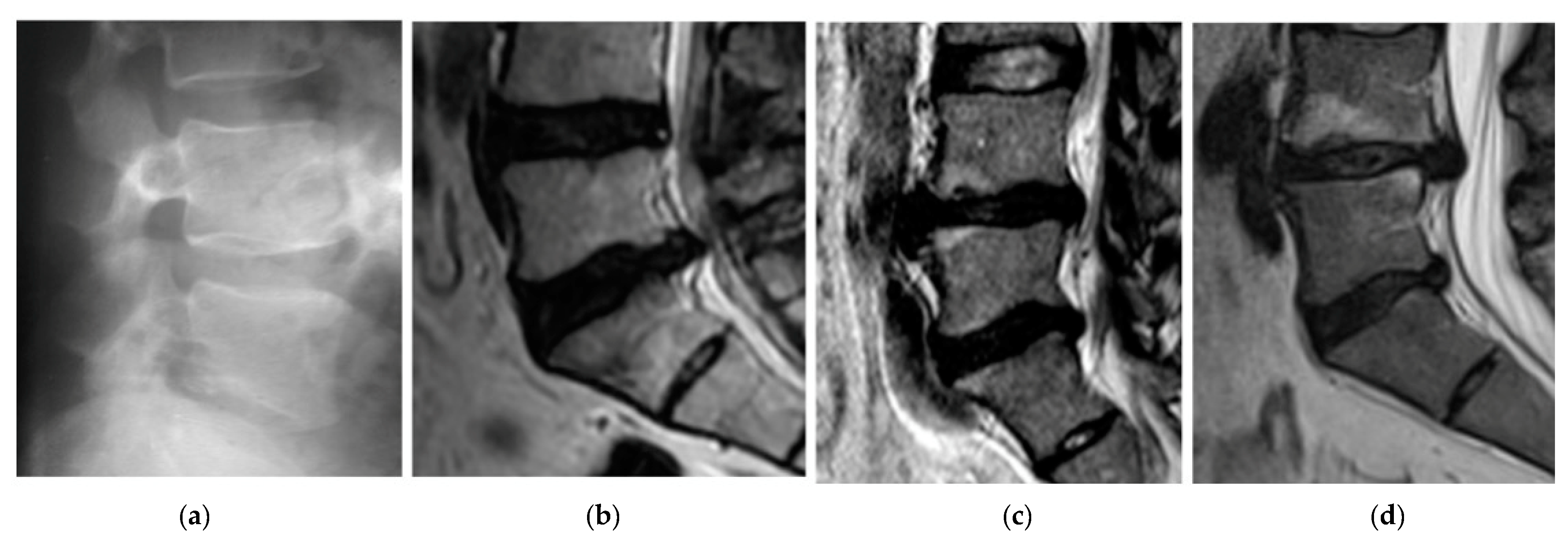 Diagnostics 10 00342 g003