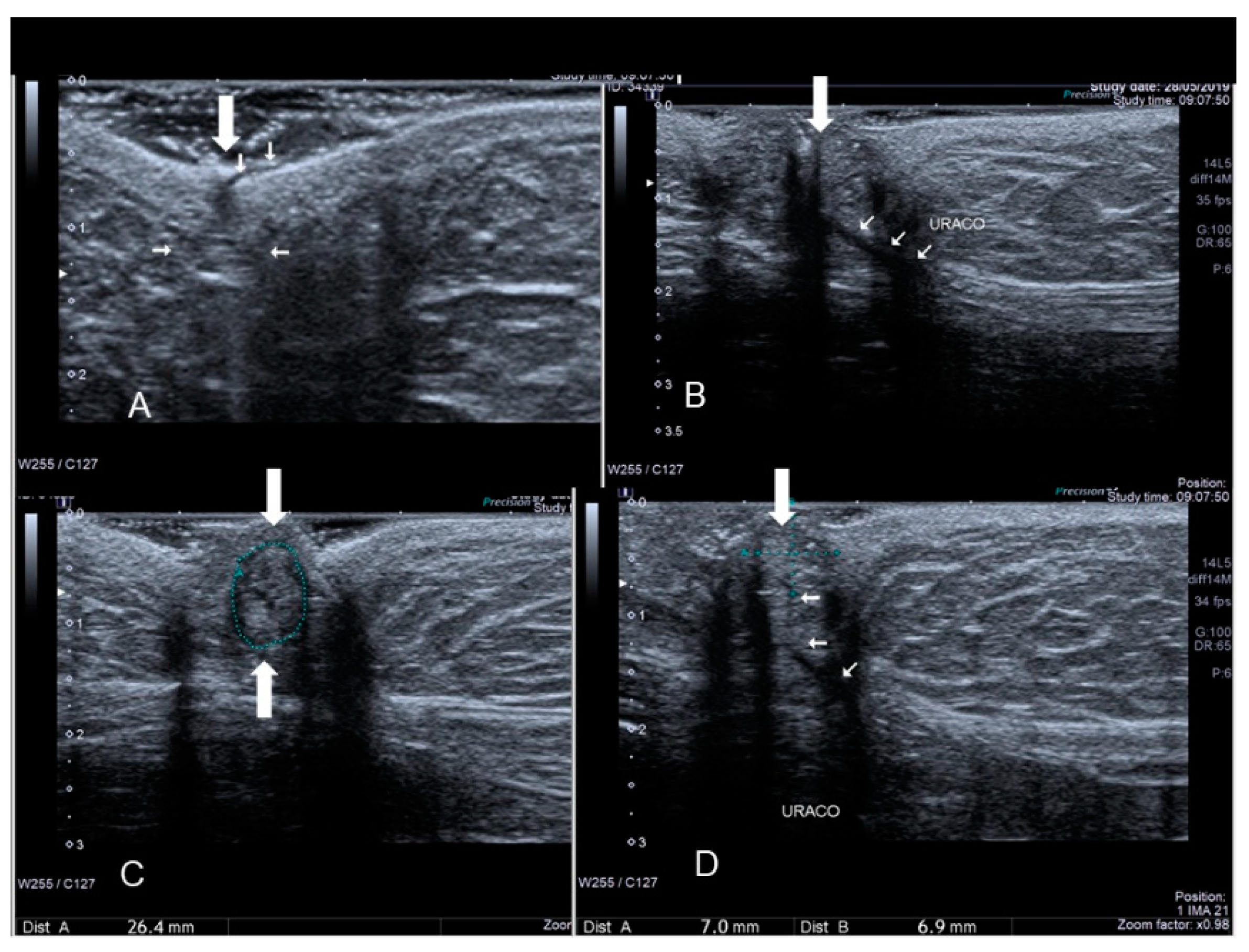 Diagnostics 10 00345 g005 Diagnostics 10 00345 g005