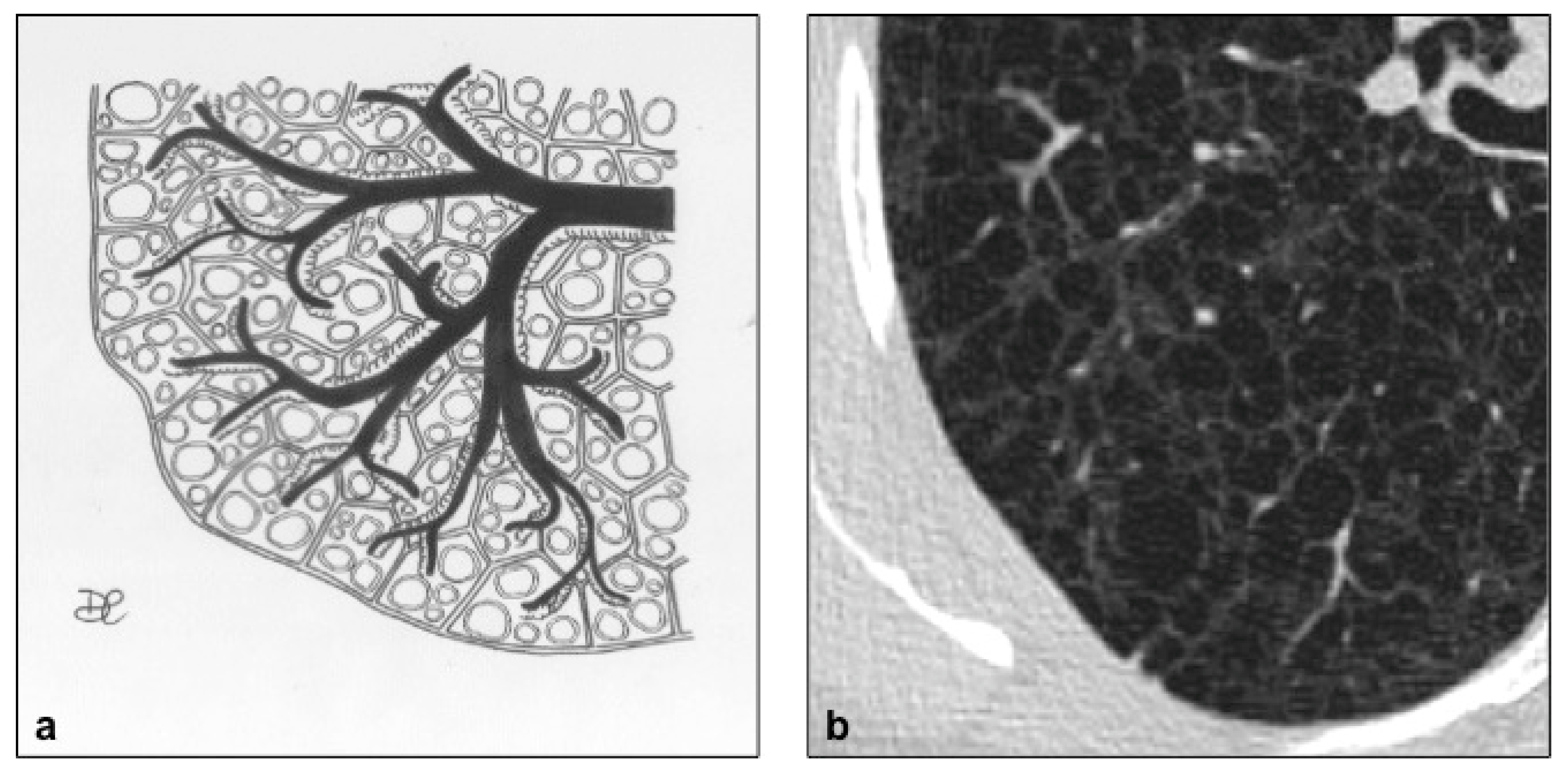 Diagnostics 10 00346 g005 Diagnostics 10 00346 g005
