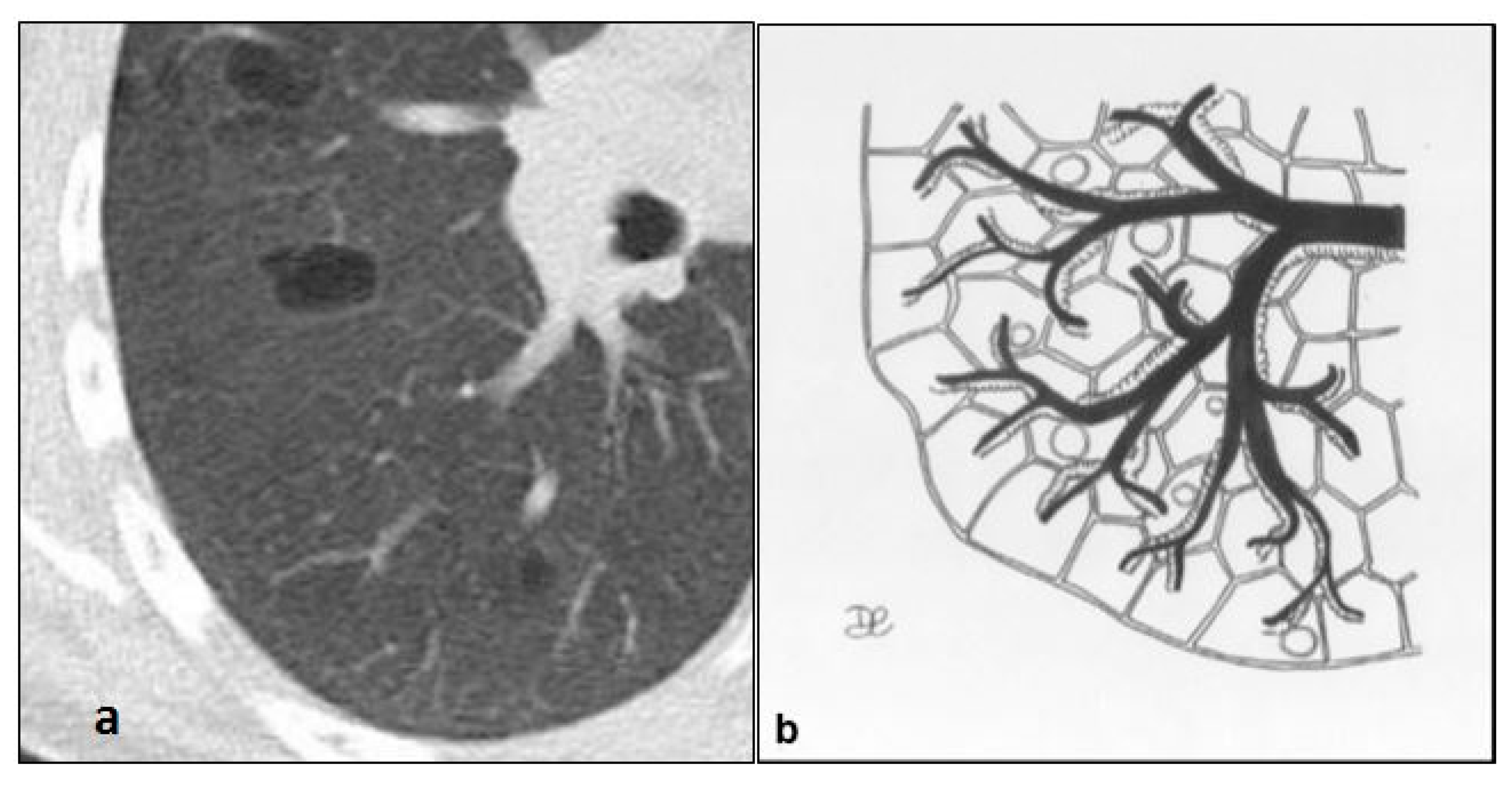 Diagnostics 10 00346 g008 Diagnostics 10 00346 g008
