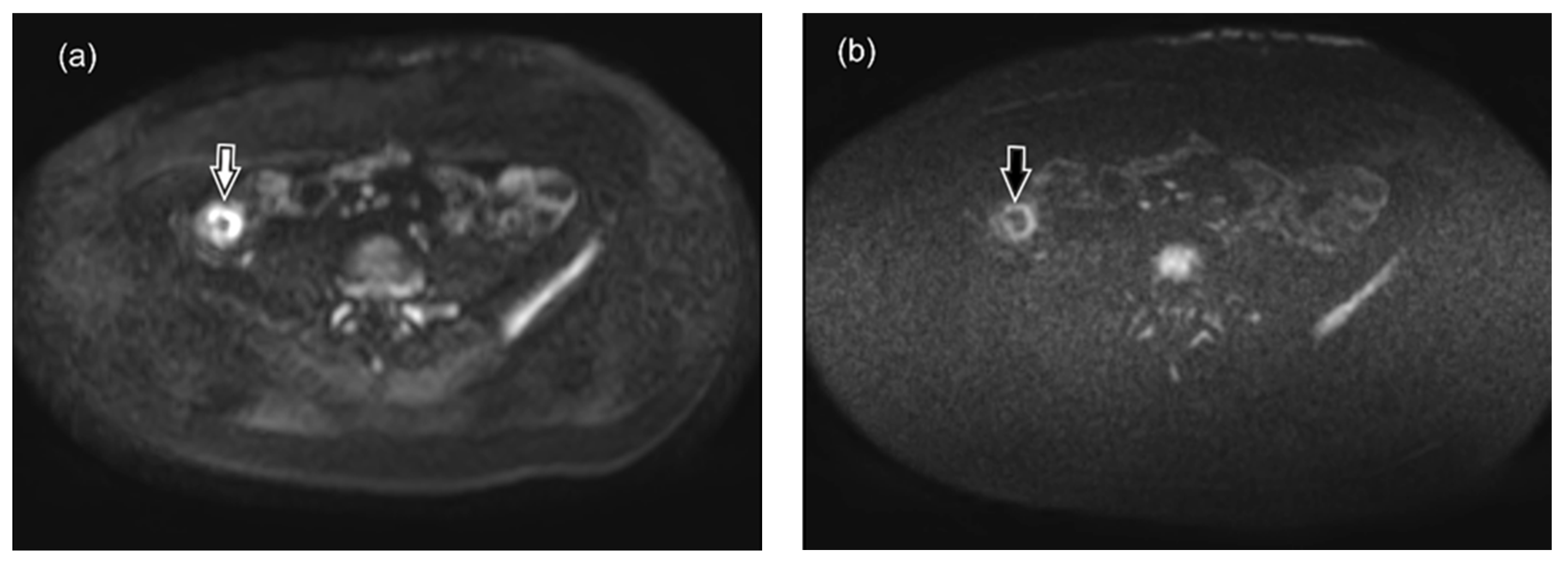 Diagnostics 10 00347 g008 Diagnostics 10 00347 g008