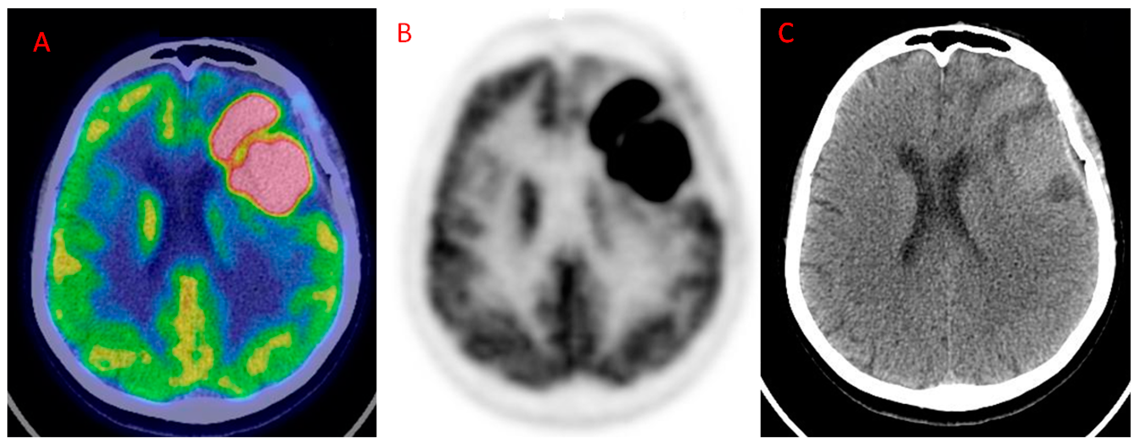 Pet Brain Scan