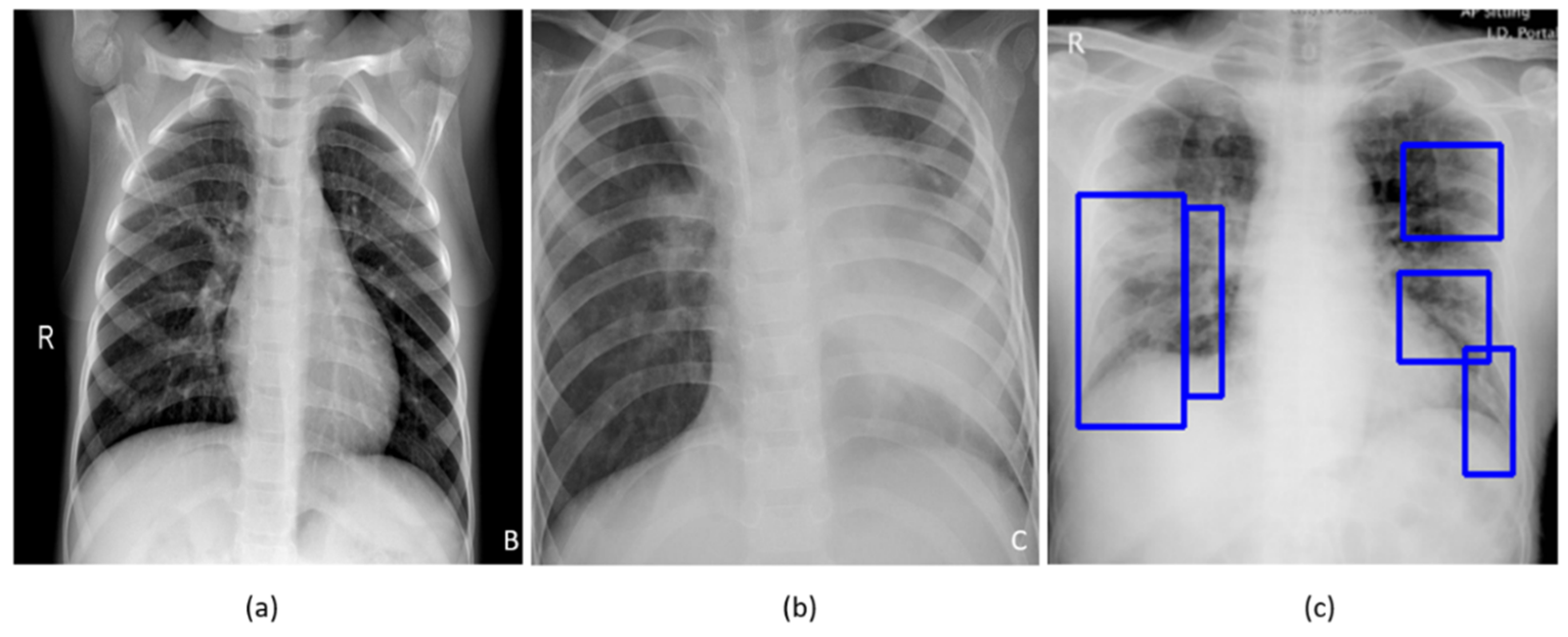 Diagnostics Free Full Text Weakly Labeled Data Augmentation For Deep Learning A Study On Covid 19 Detection In Chest X Rays Html