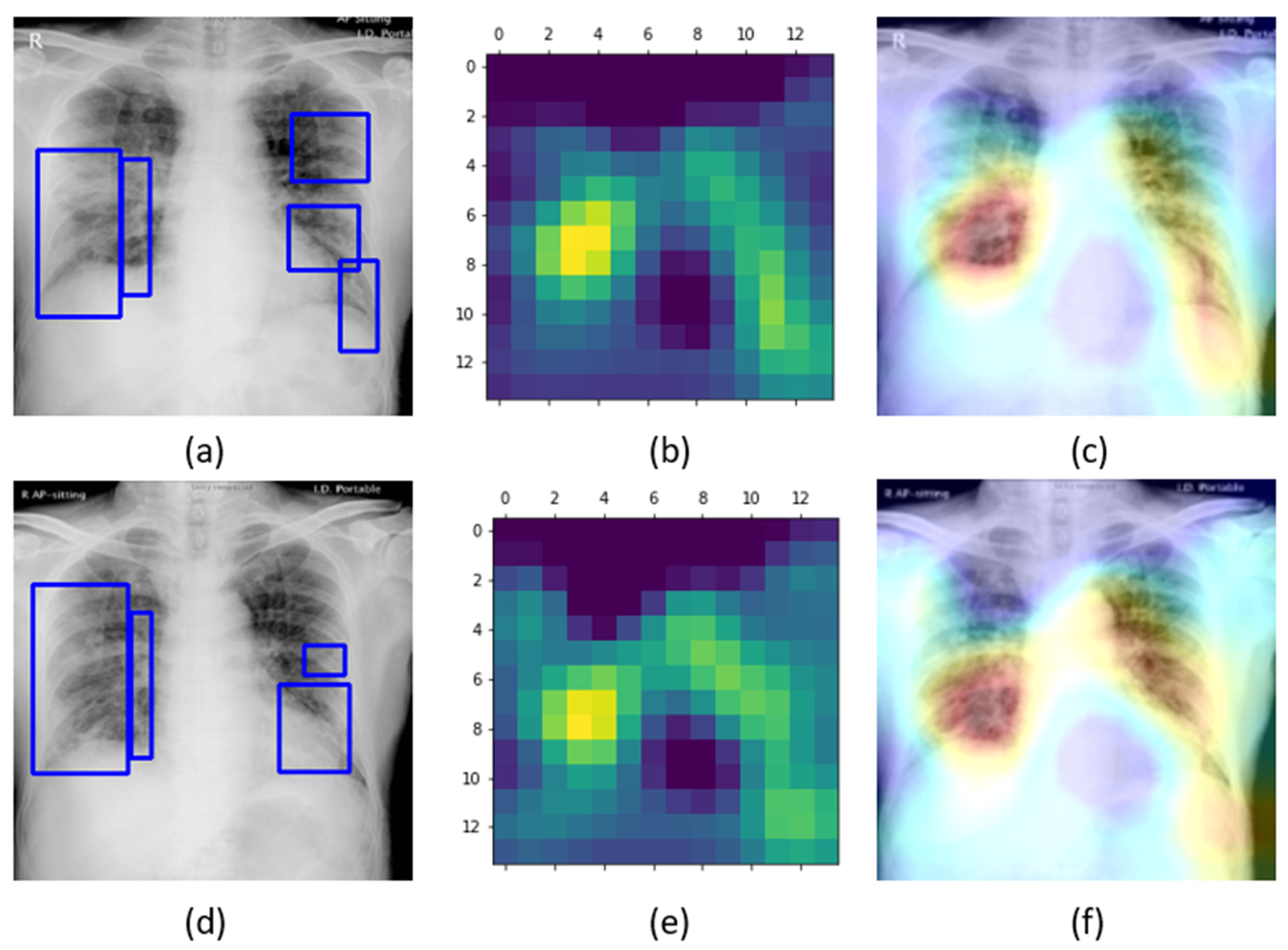 Diagnostics 10 00358 g008
