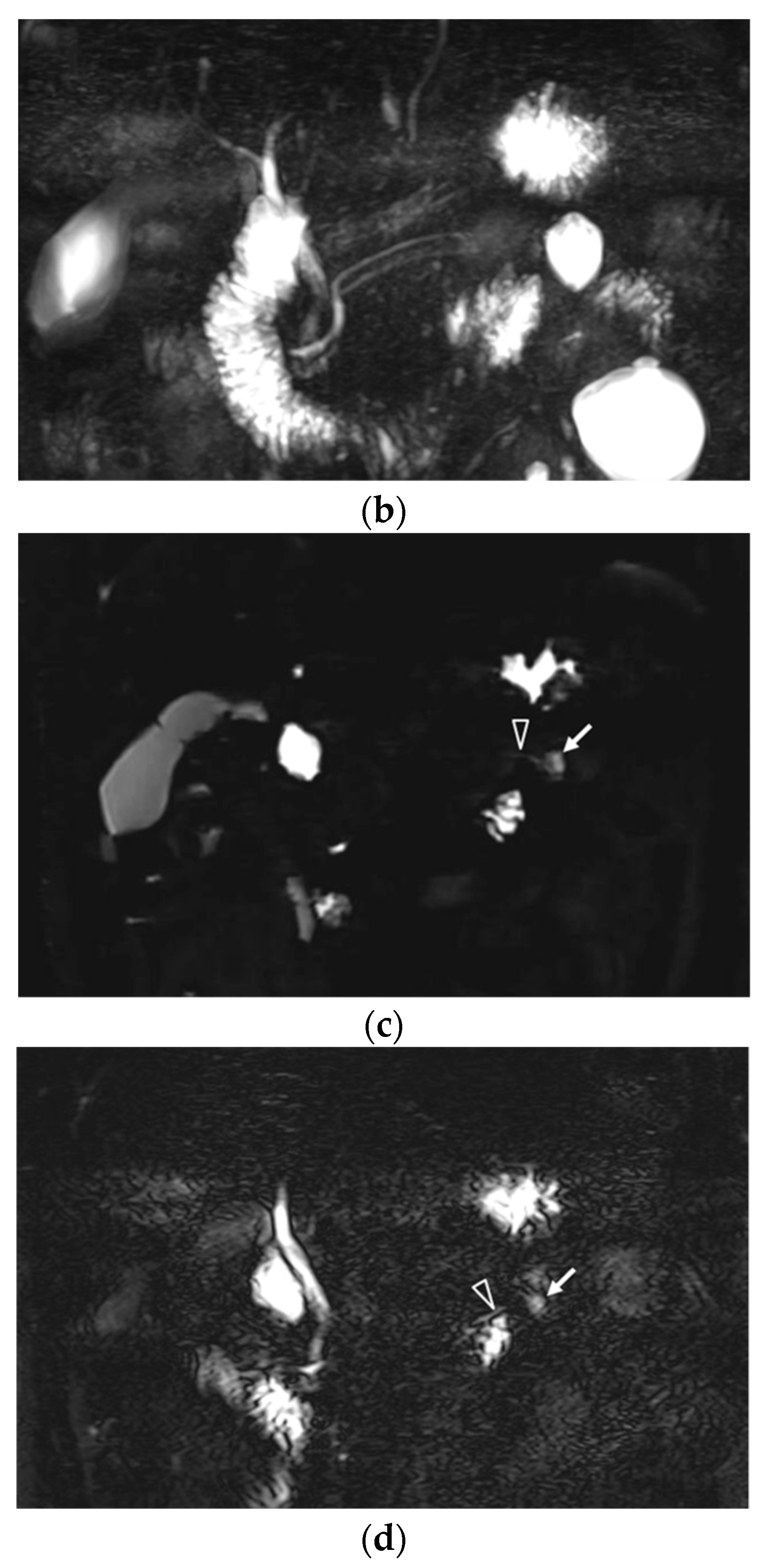 Diagnostics 10 00376 g002b