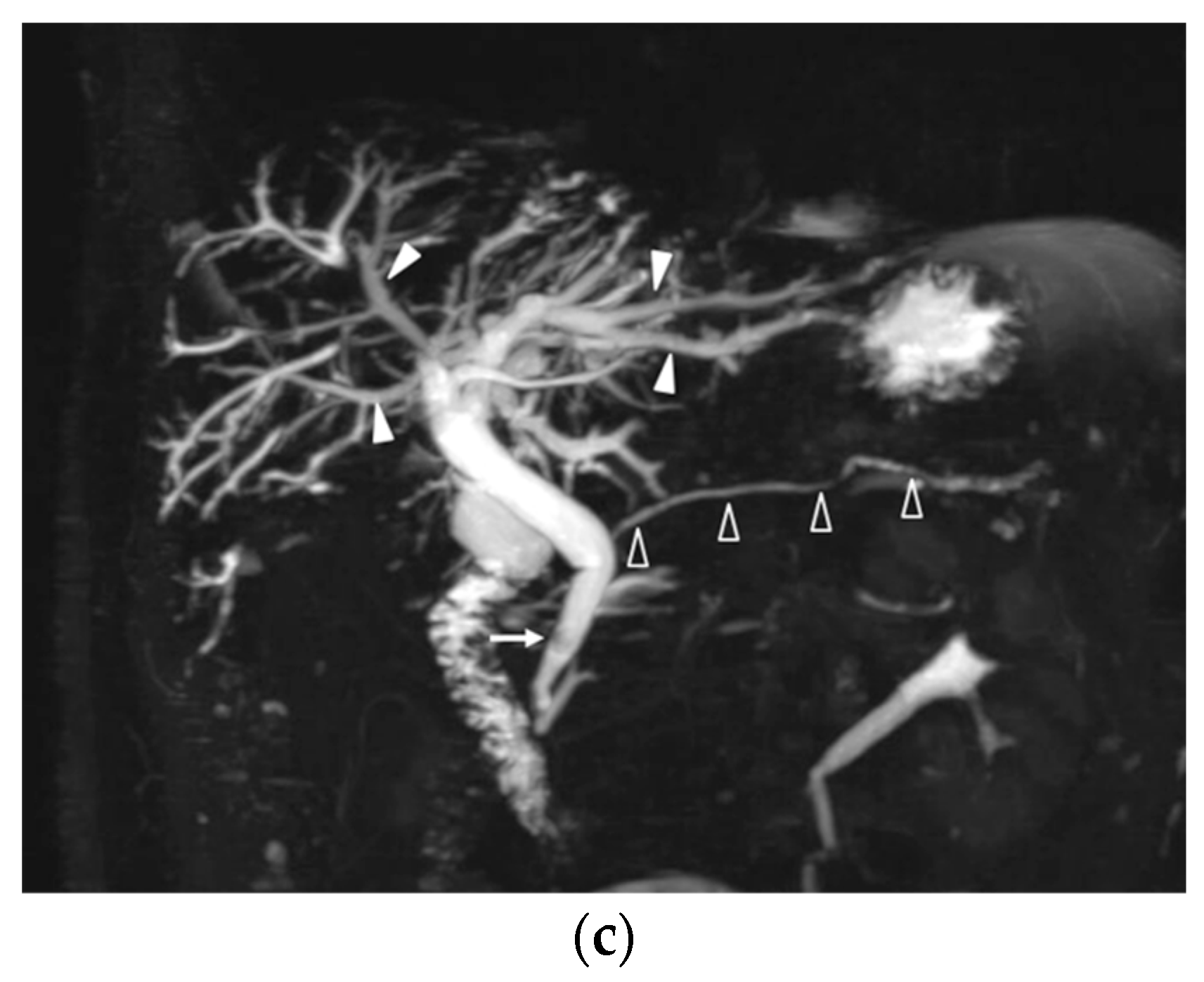 Diagnostics 10 00376 g003b
