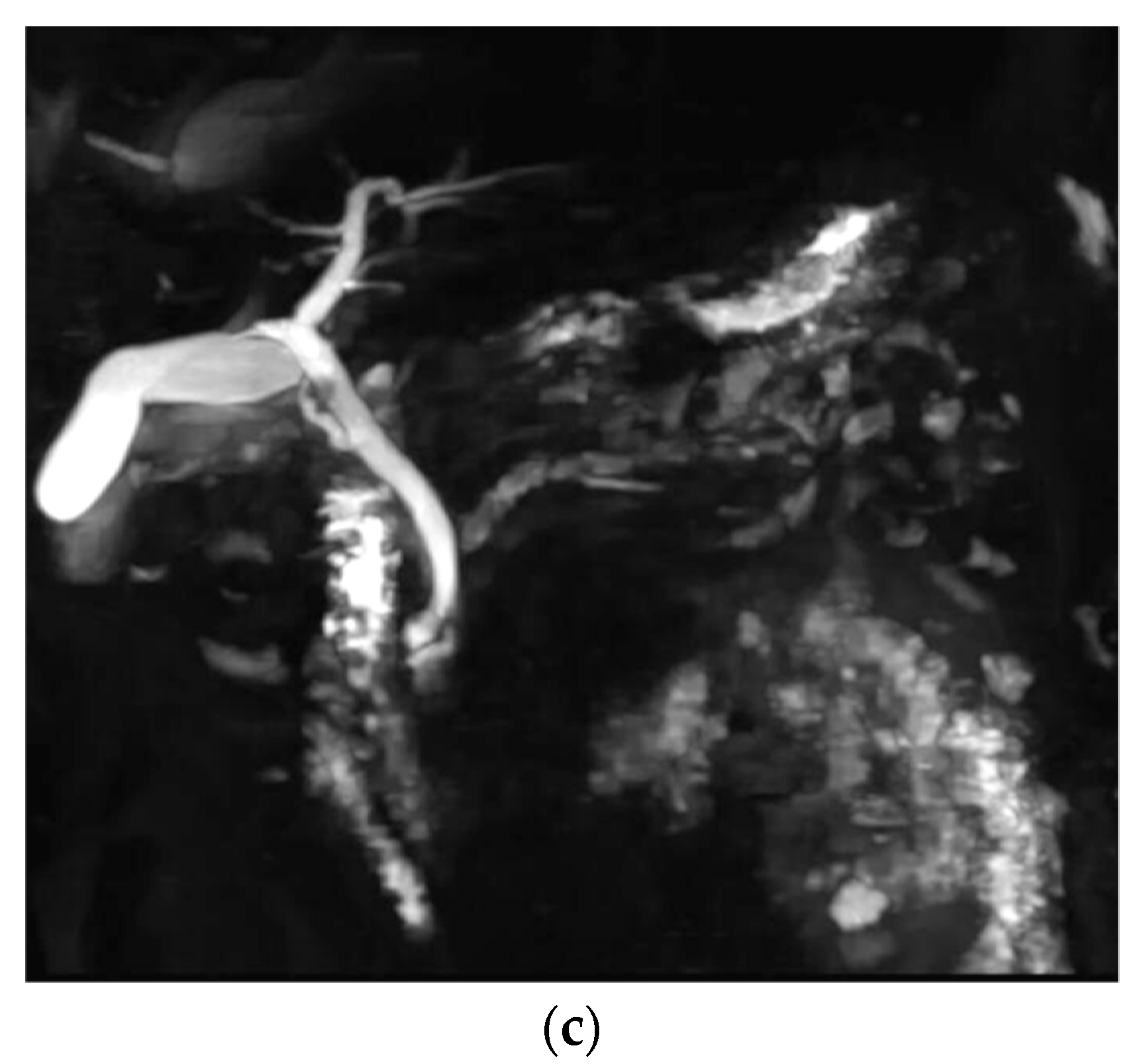 Diagnostics 10 00376 g004b