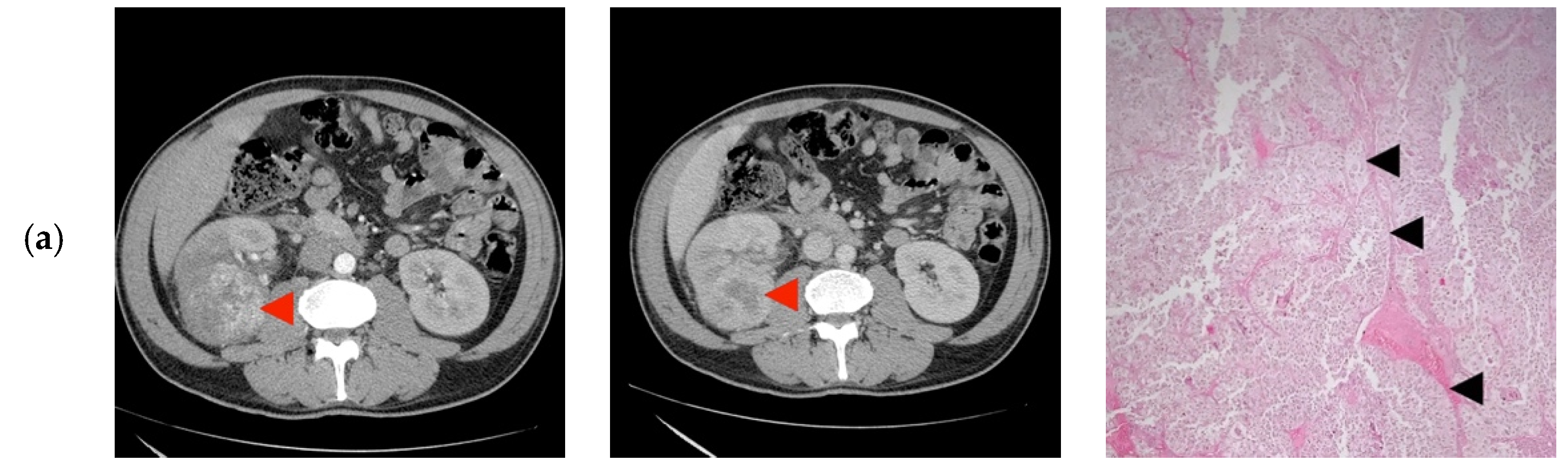 Diagnostics 10 00380 g002a Diagnostics 10 00380 g002a