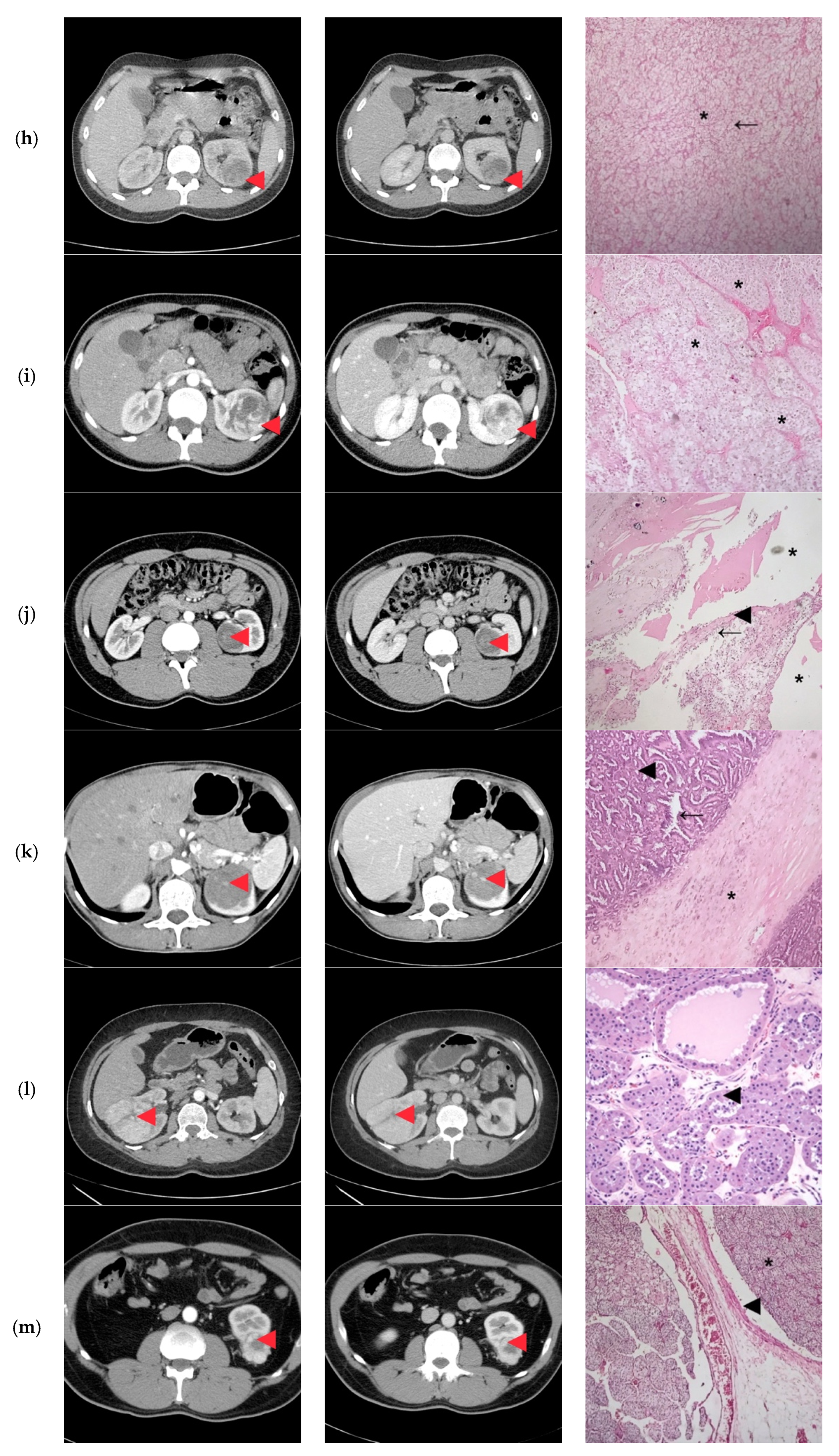 Diagnostics 10 00380 g002c Diagnostics 10 00380 g002c