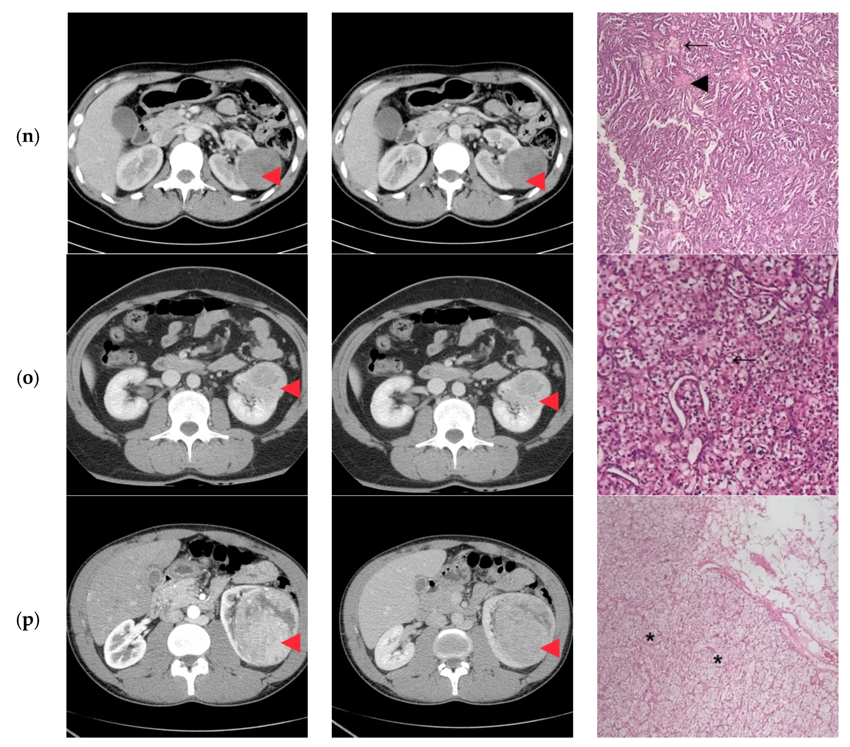 Diagnostics 10 00380 g002d Diagnostics 10 00380 g002d