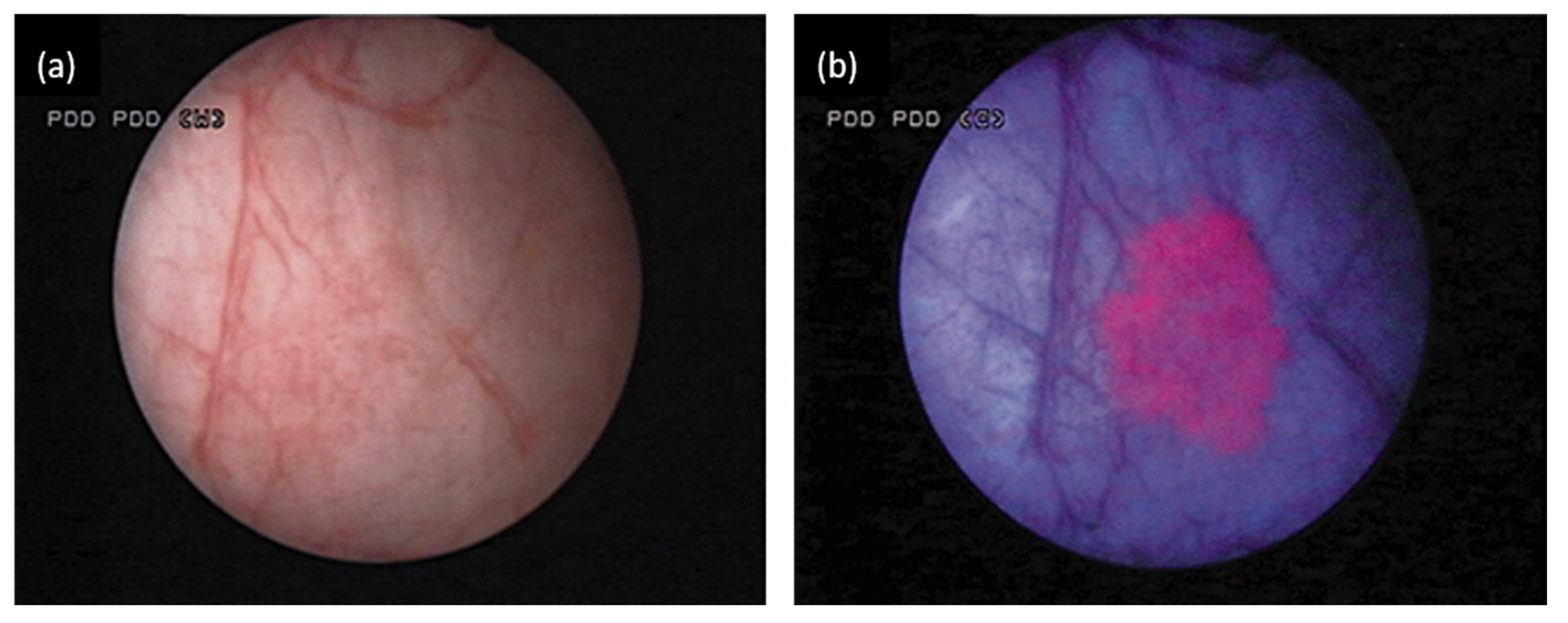 Diagnostics 10 00383 g003