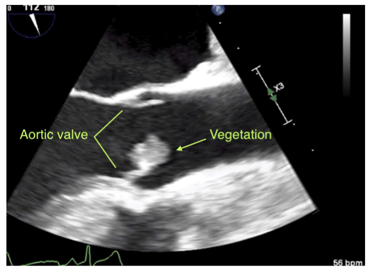 Diagnostics 10 00384 g002 Diagnostics 10 00384 g002