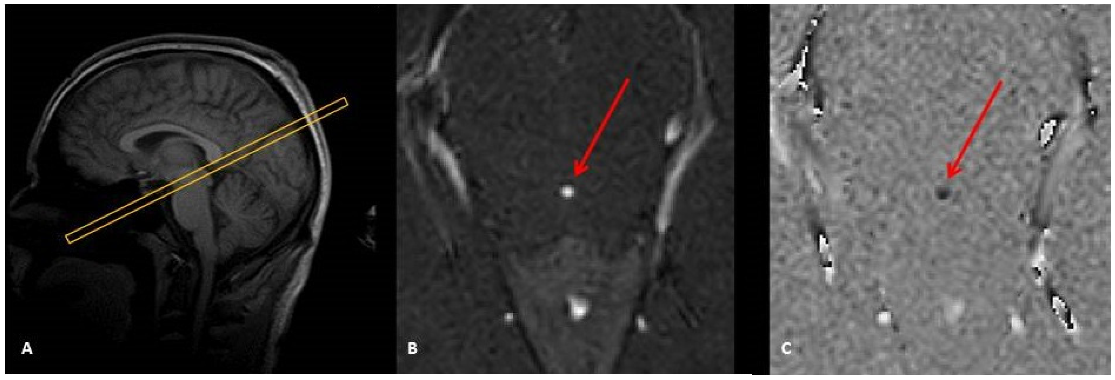 Diagnostics 10 00387 g001
