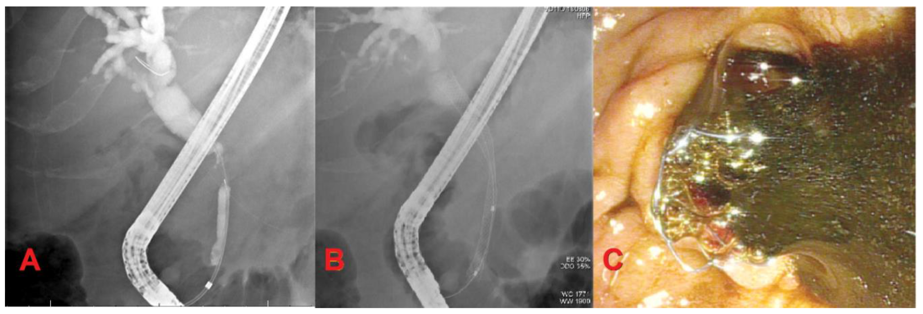 Diagnostics 10 00390 g001