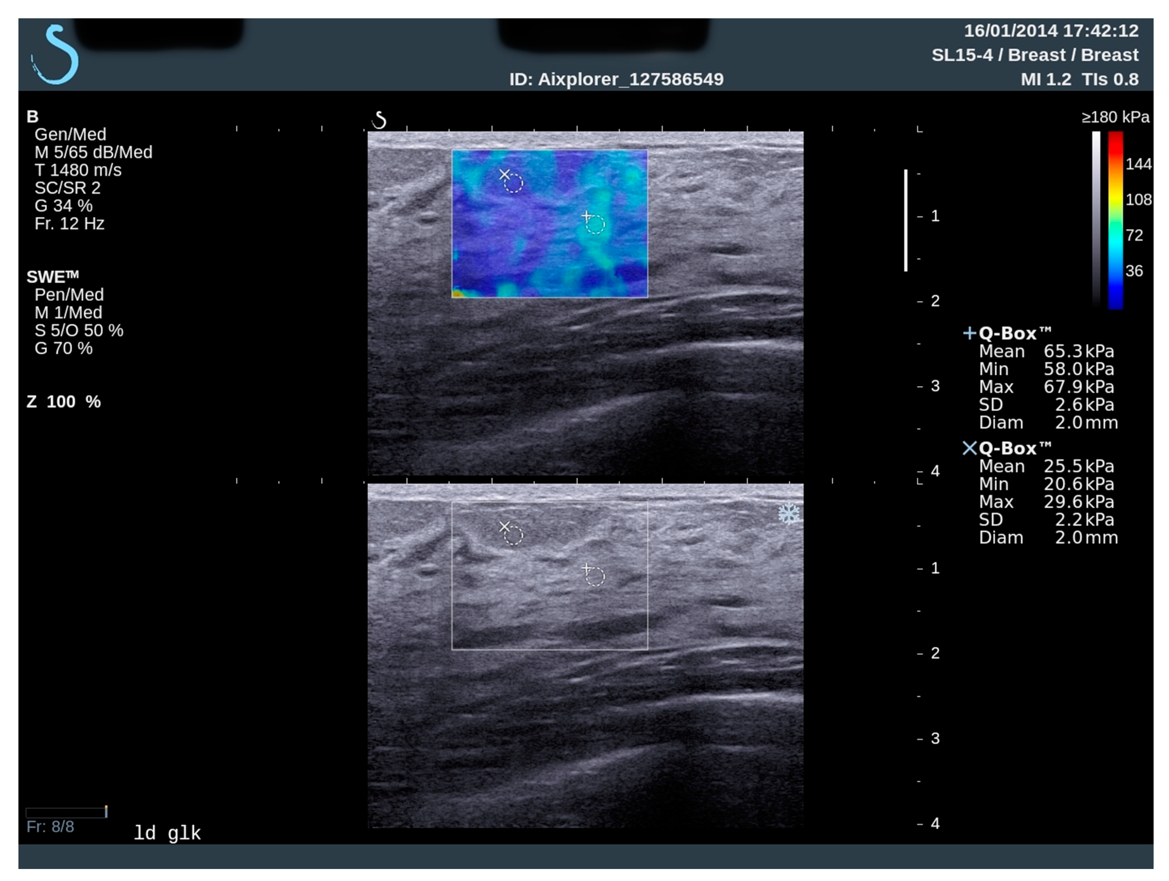 Diagnostics Free Full Text Exploring Association Of Breast Pain Pregnancy And Body Mass Index With Breast Tissue Elasticity In Healthy Women Glandular And Fat Differences Html Diagnostics Free Full Text Exploring Association Of Breast Pain Pregnancy And Body Mass Index With Breast Tissue Elasticity In Healthy Women Glandular And Fat Differences Html
