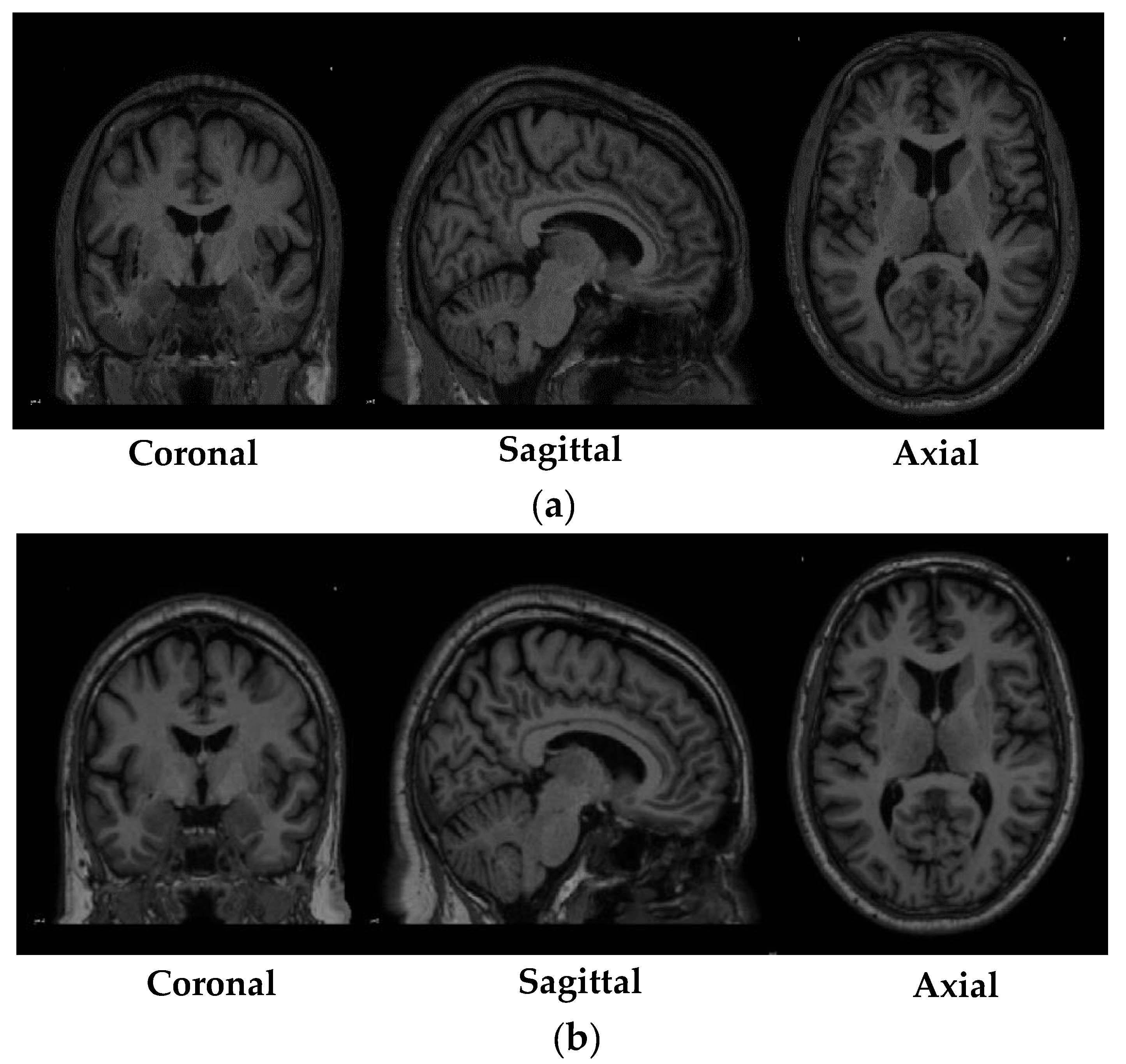 Diagnostics | Full-Text | Detection of Disease from 3T Weighted MRI Scans Using 3D Convolutional Neural
