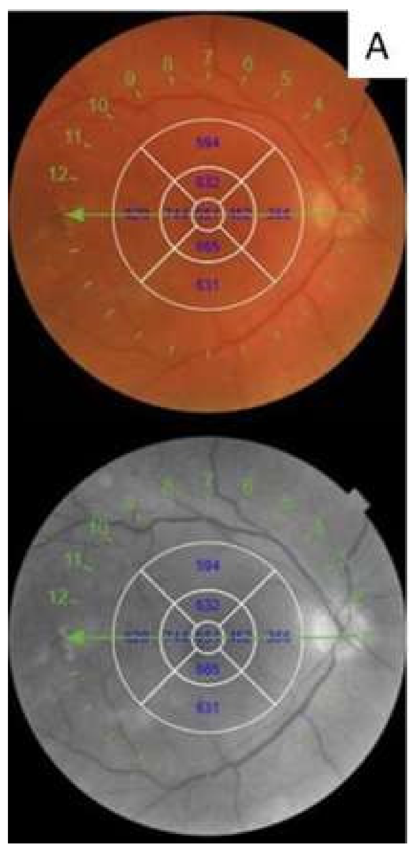 Diagnostics 10 00413 g001a Diagnostics 10 00413 g001a