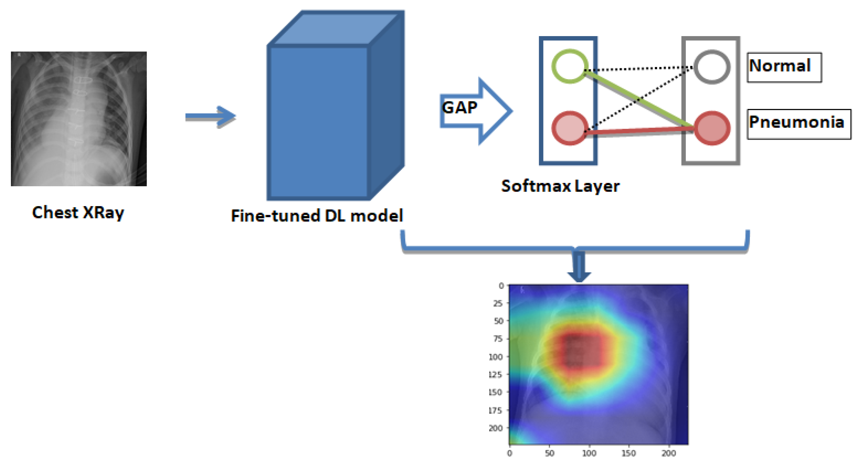 Diagnostics Free FullText Efficient Pneumonia Detection in Chest