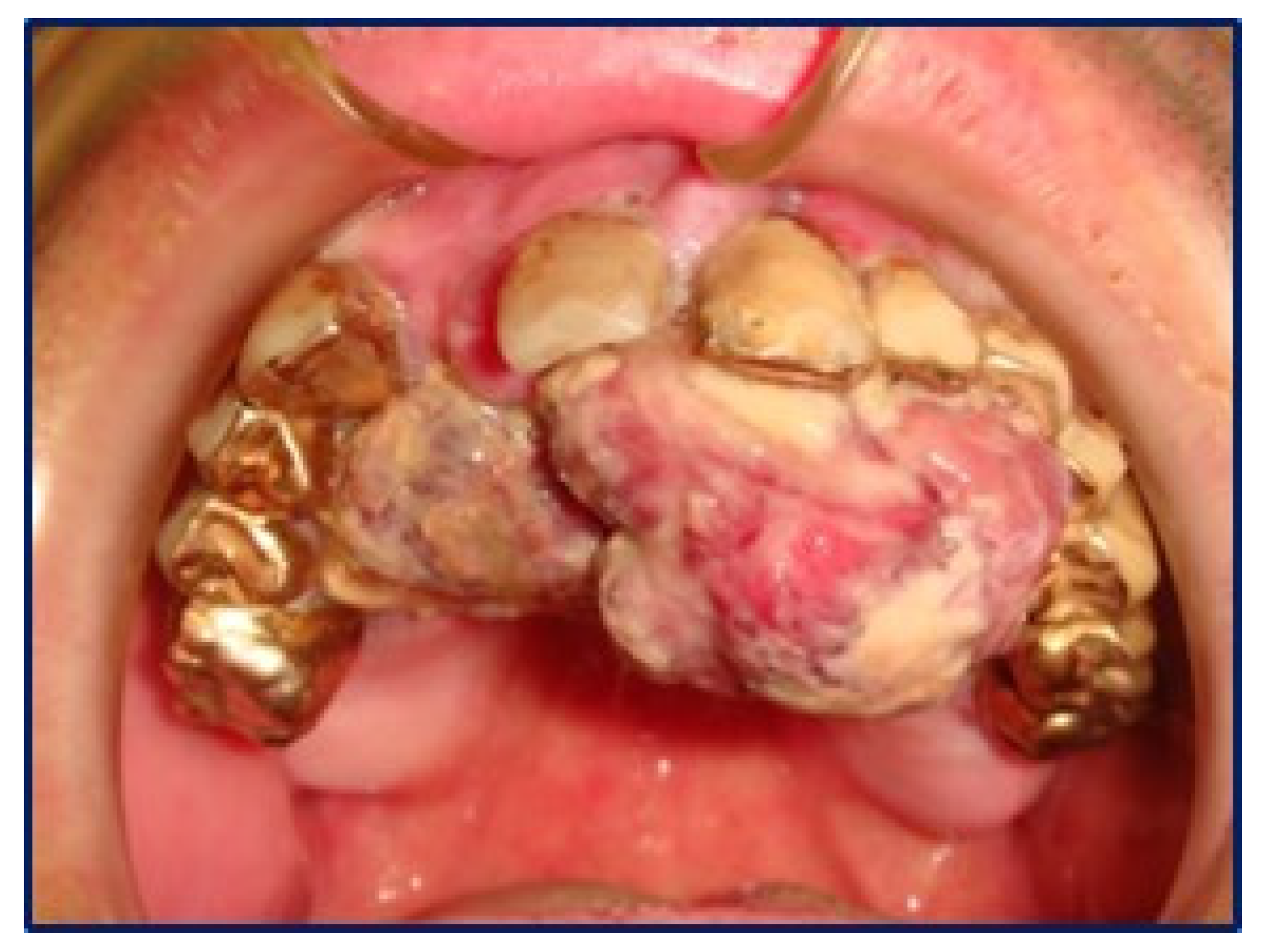 Diagnostics 10 00424 g001 550