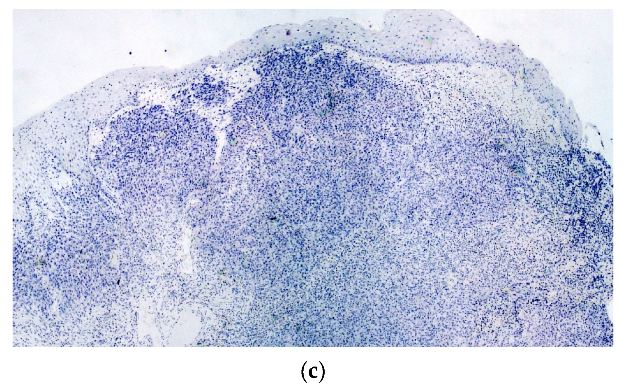 Diagnostics 10 00424 g006b 550