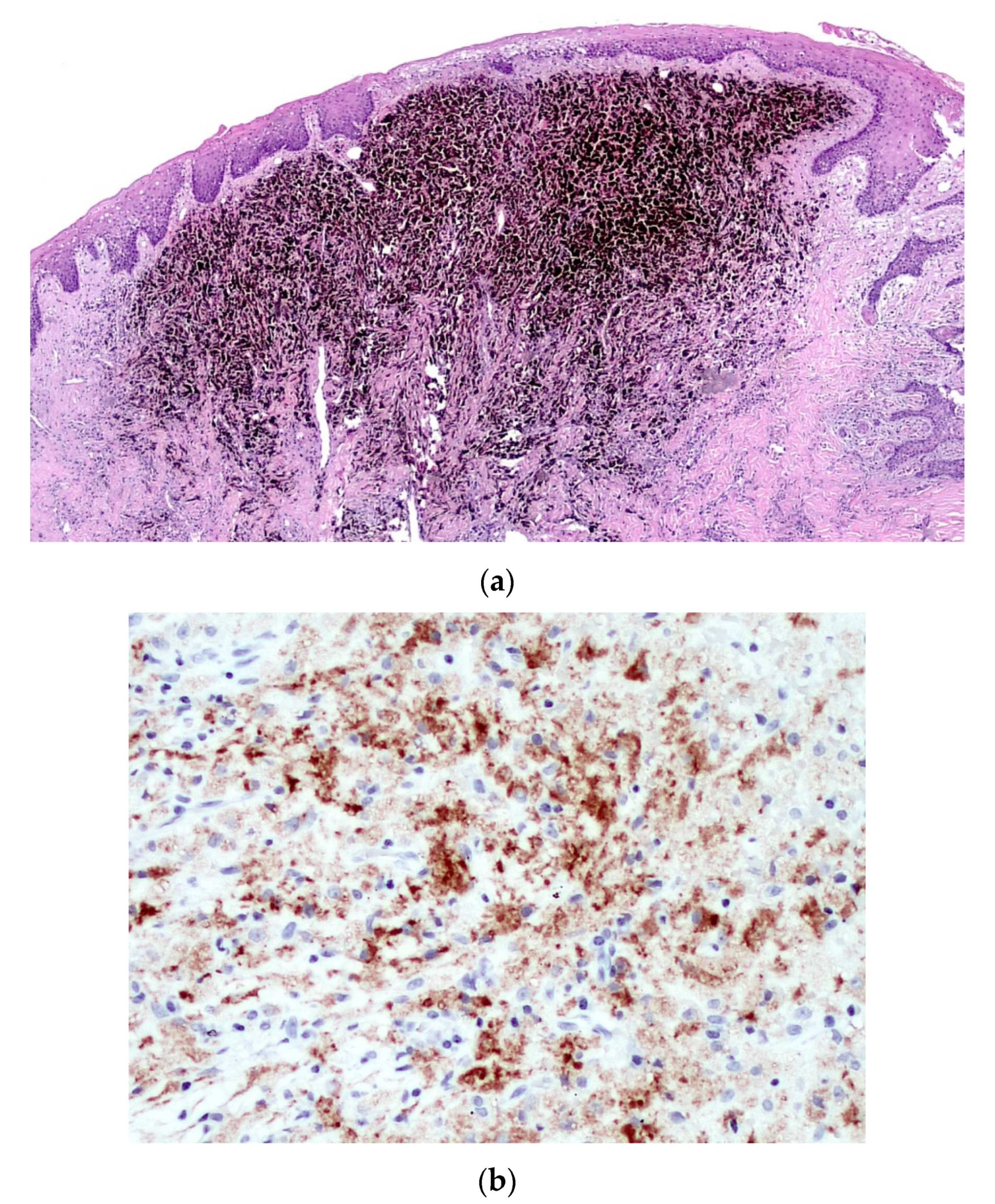 Diagnostics 10 00424 g007 550