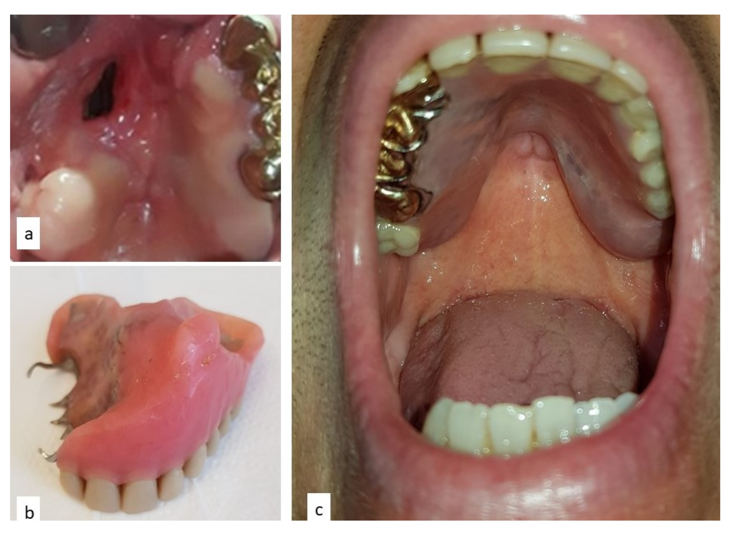 Diagnostics 10 00424 g008 550
