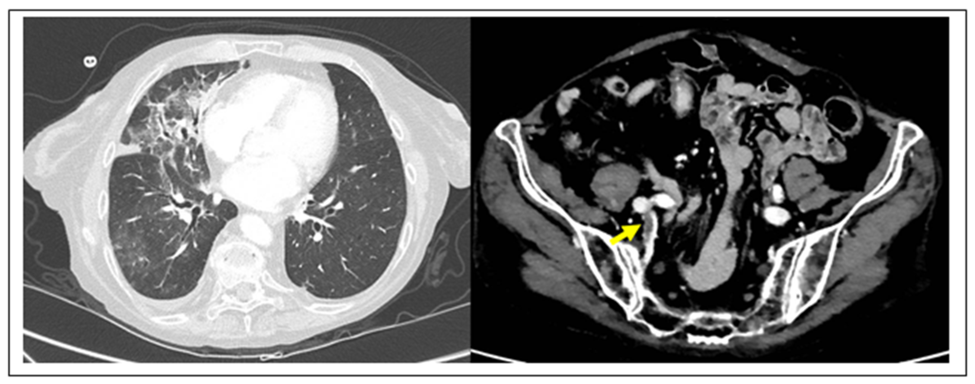 Diagnostics 10 00440 g001 Diagnostics 10 00440 g001