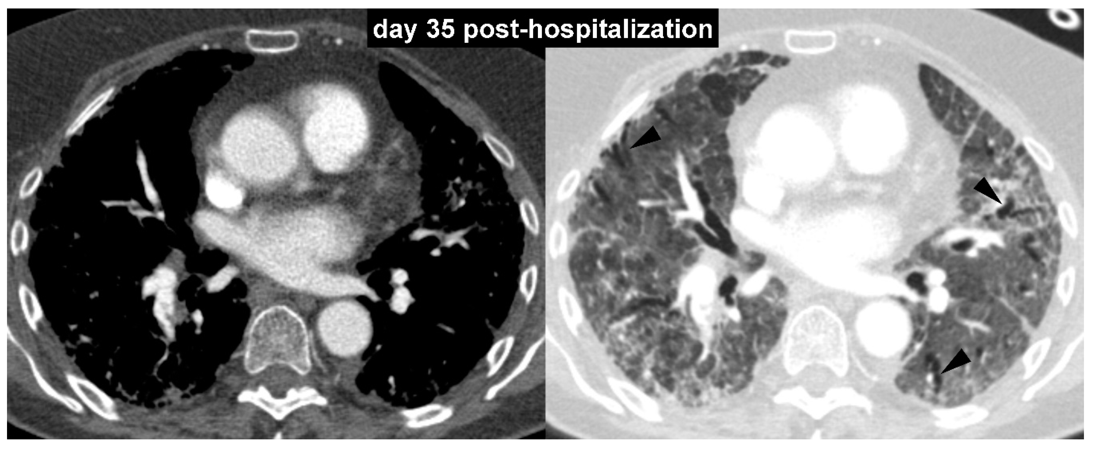 Diagnostics 10 00498 g002 Diagnostics 10 00498 g002