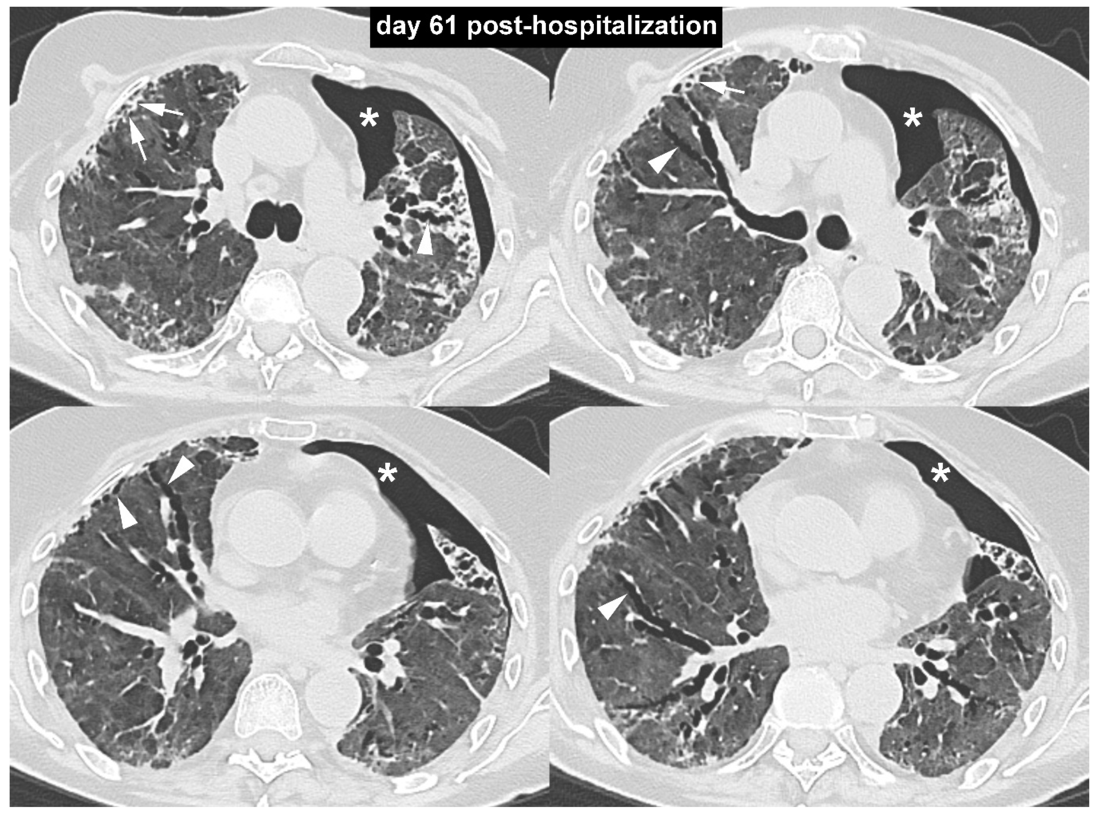 Diagnostics 10 00498 g003 Diagnostics 10 00498 g003