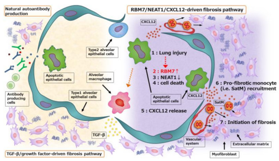 Revisiting Cell Death Responses in Fibrotic Lung Disease: Crosstalk ...