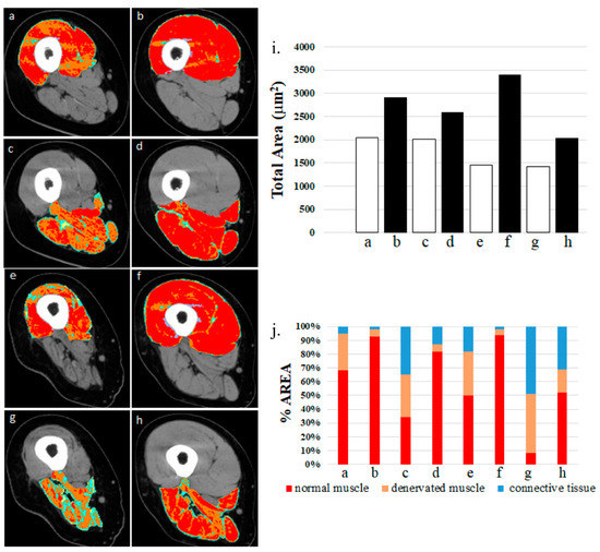 Electrical stimulation found to revitalize muscle perfusion caused