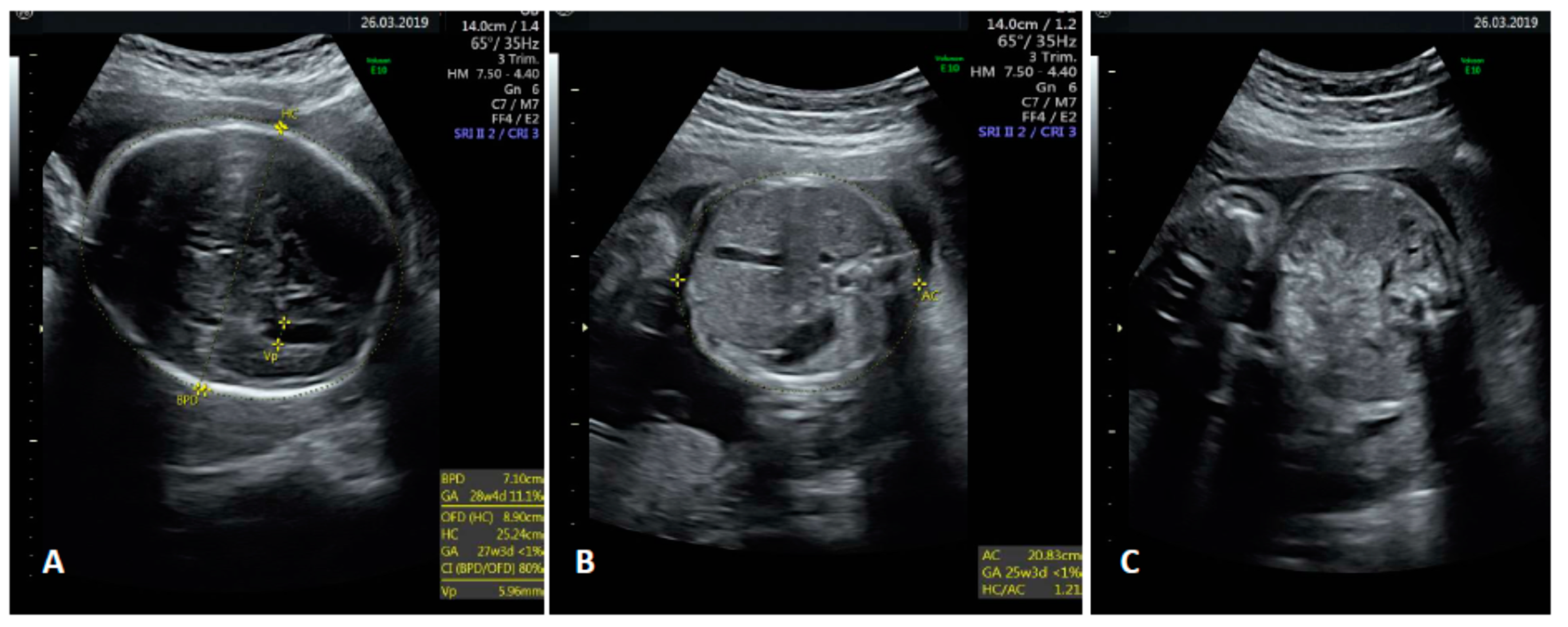 Diagnostics 10 00542 g002 Diagnostics 10 00542 g002