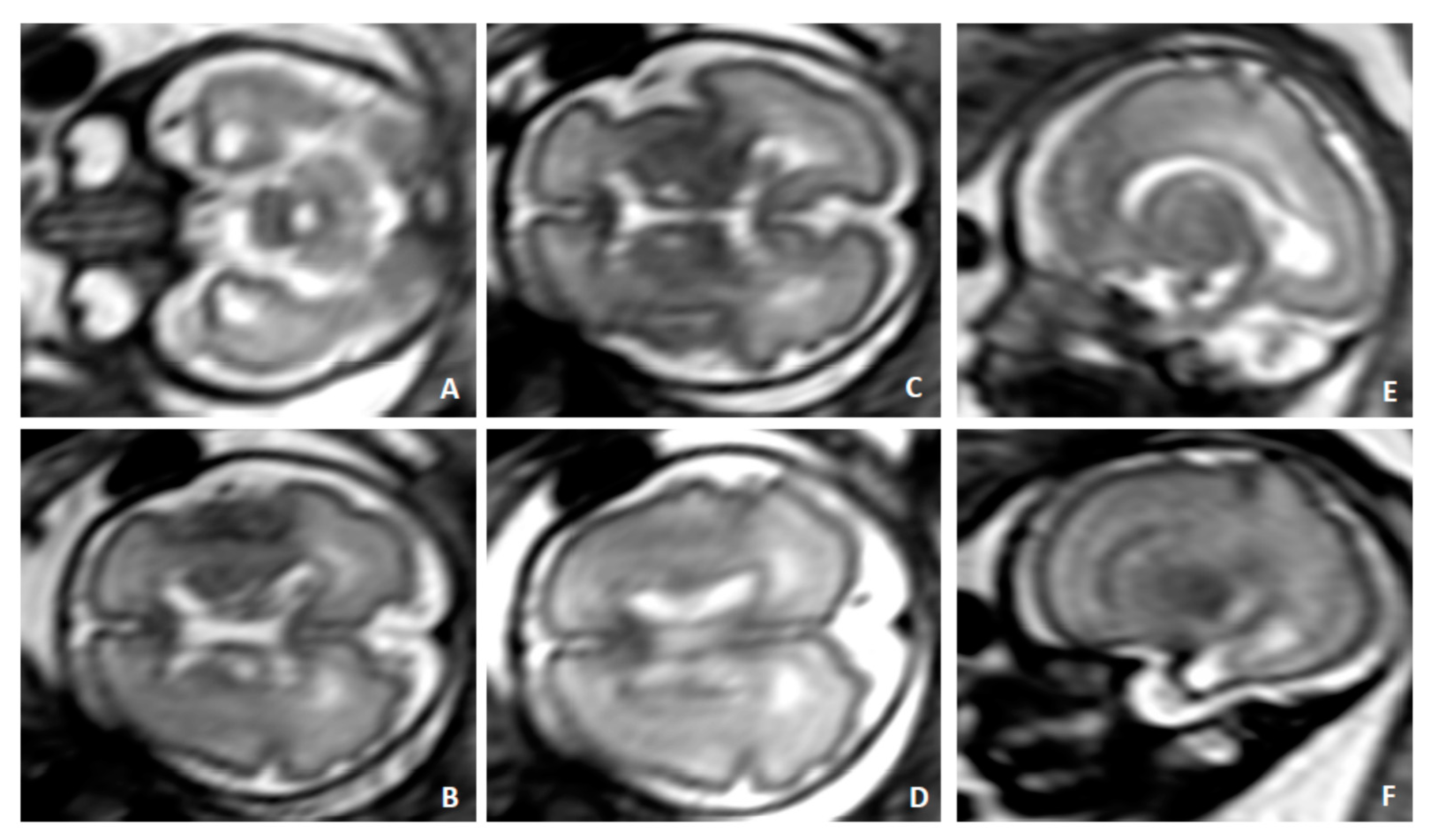 Diagnostics 10 00542 g003 Diagnostics 10 00542 g003