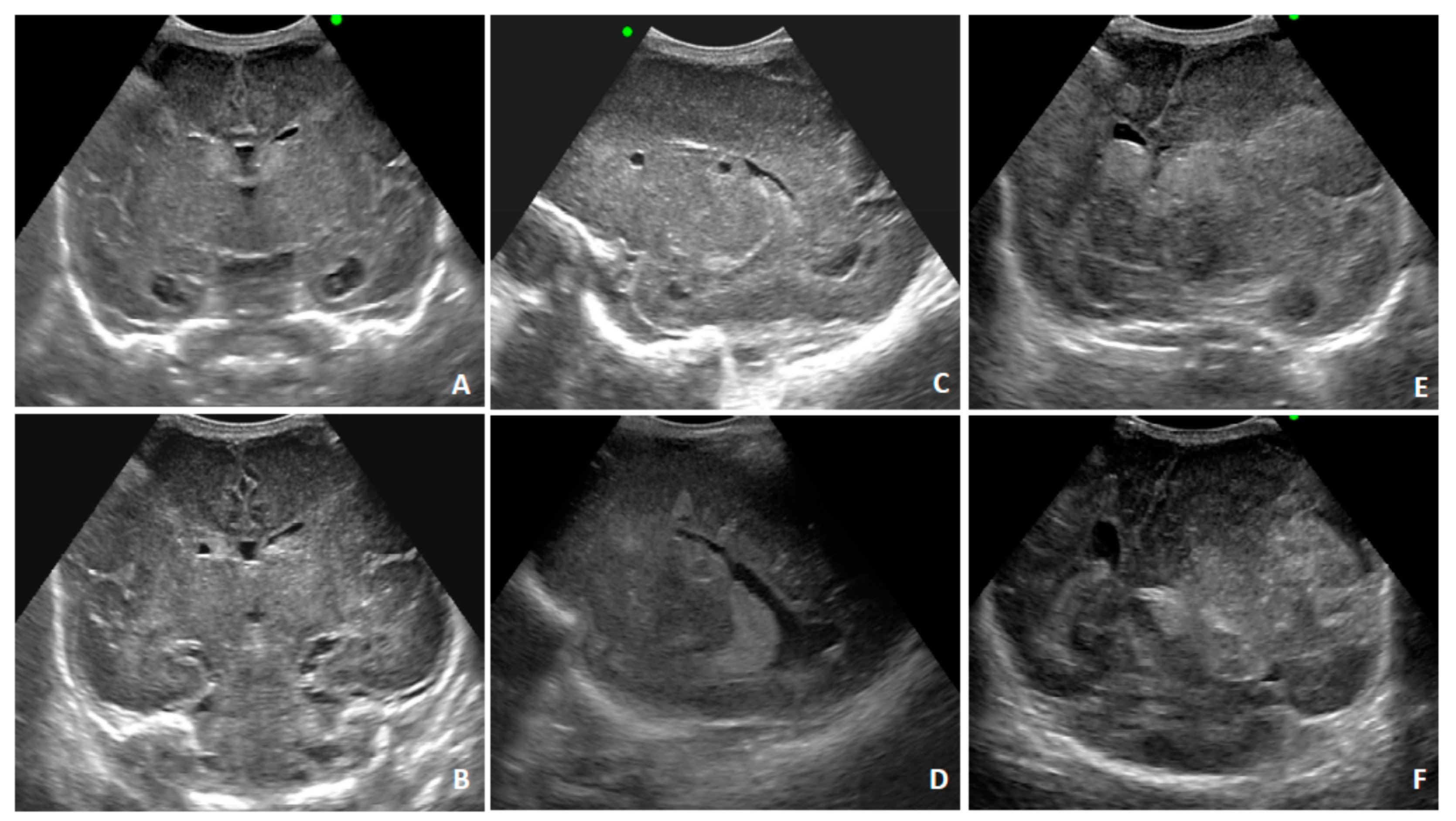 Diagnostics 10 00542 g004 Diagnostics 10 00542 g004