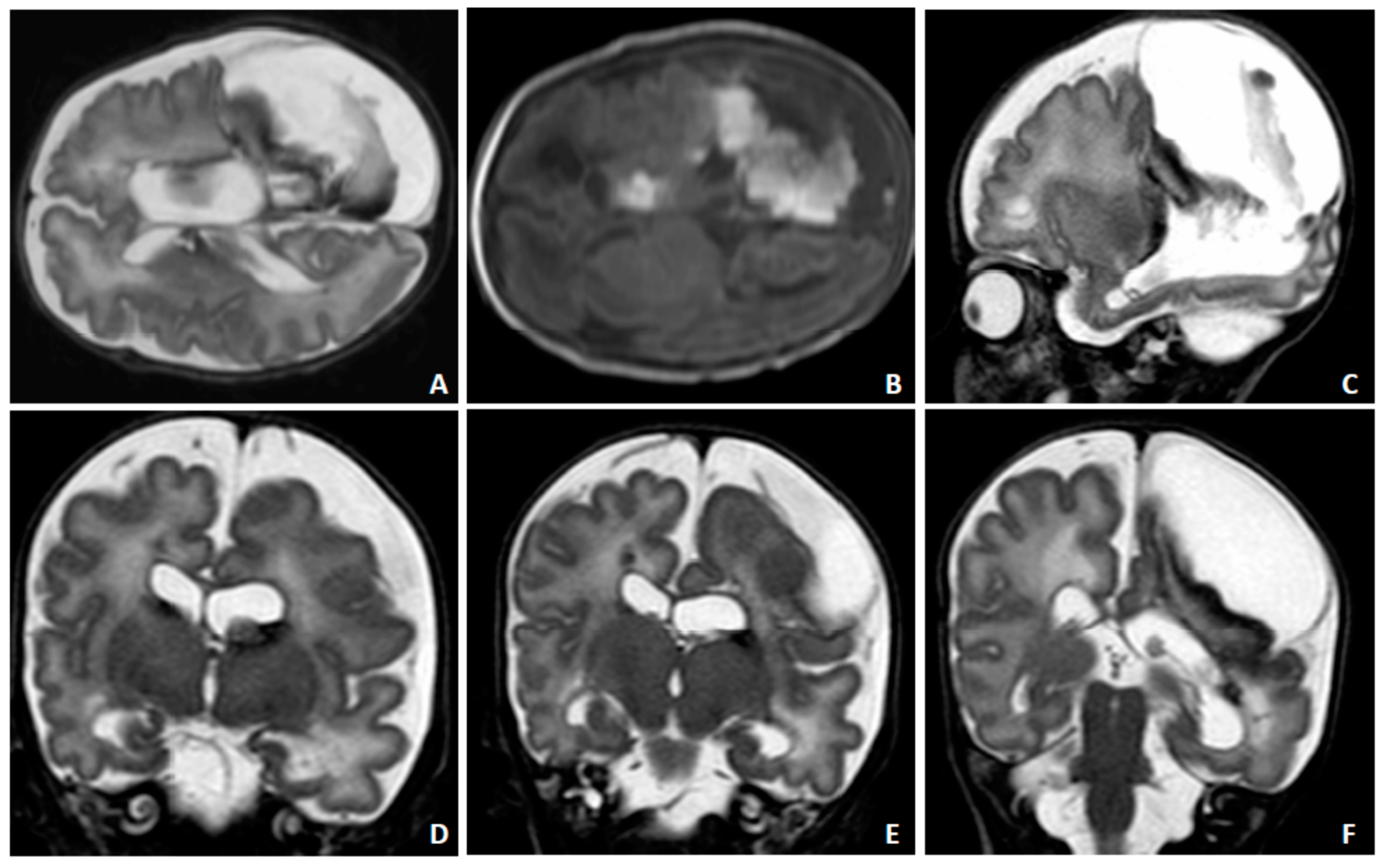 Diagnostics 10 00542 g005 Diagnostics 10 00542 g005