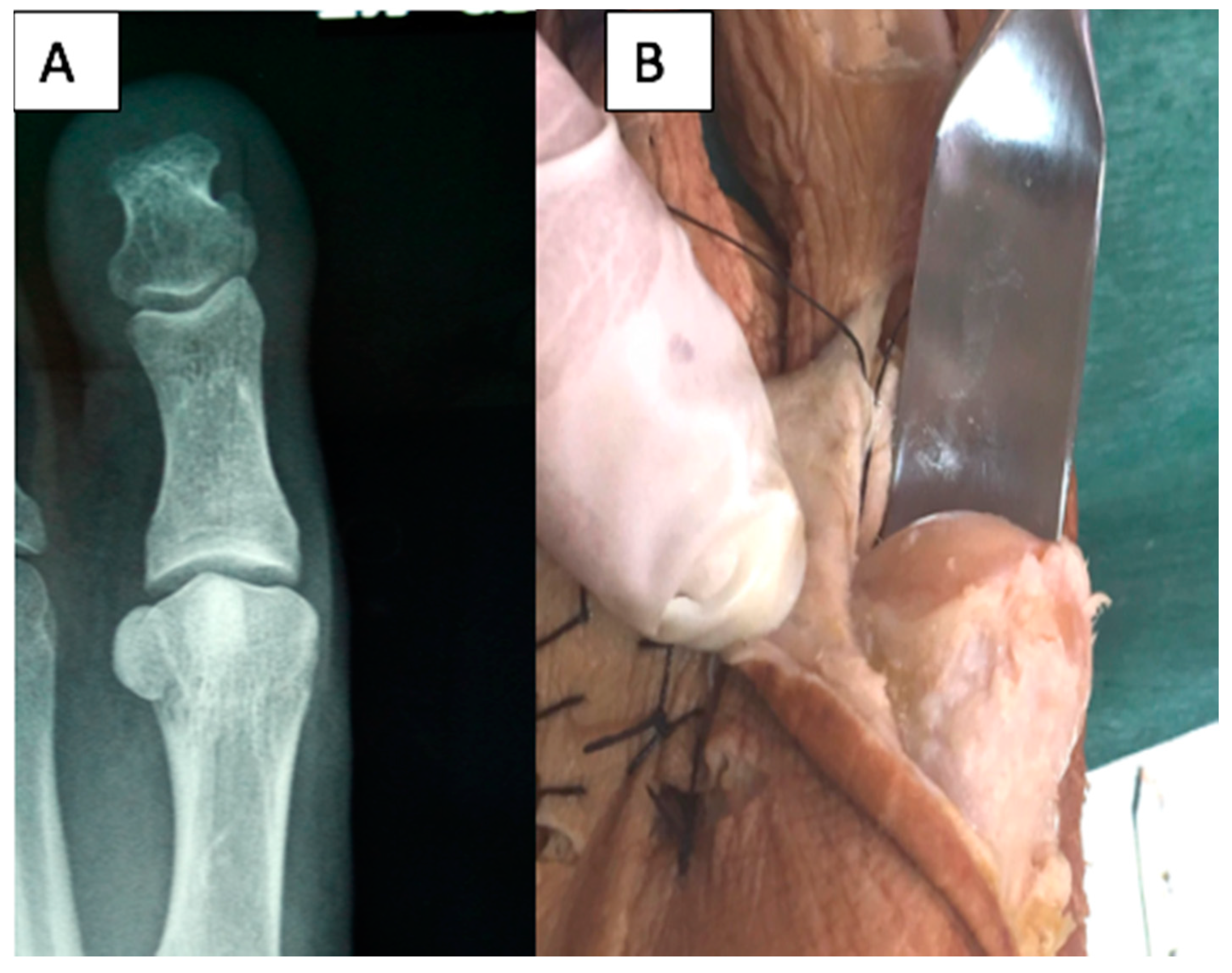 Diagnostics 10 00552 g002 Diagnostics 10 00552 g002