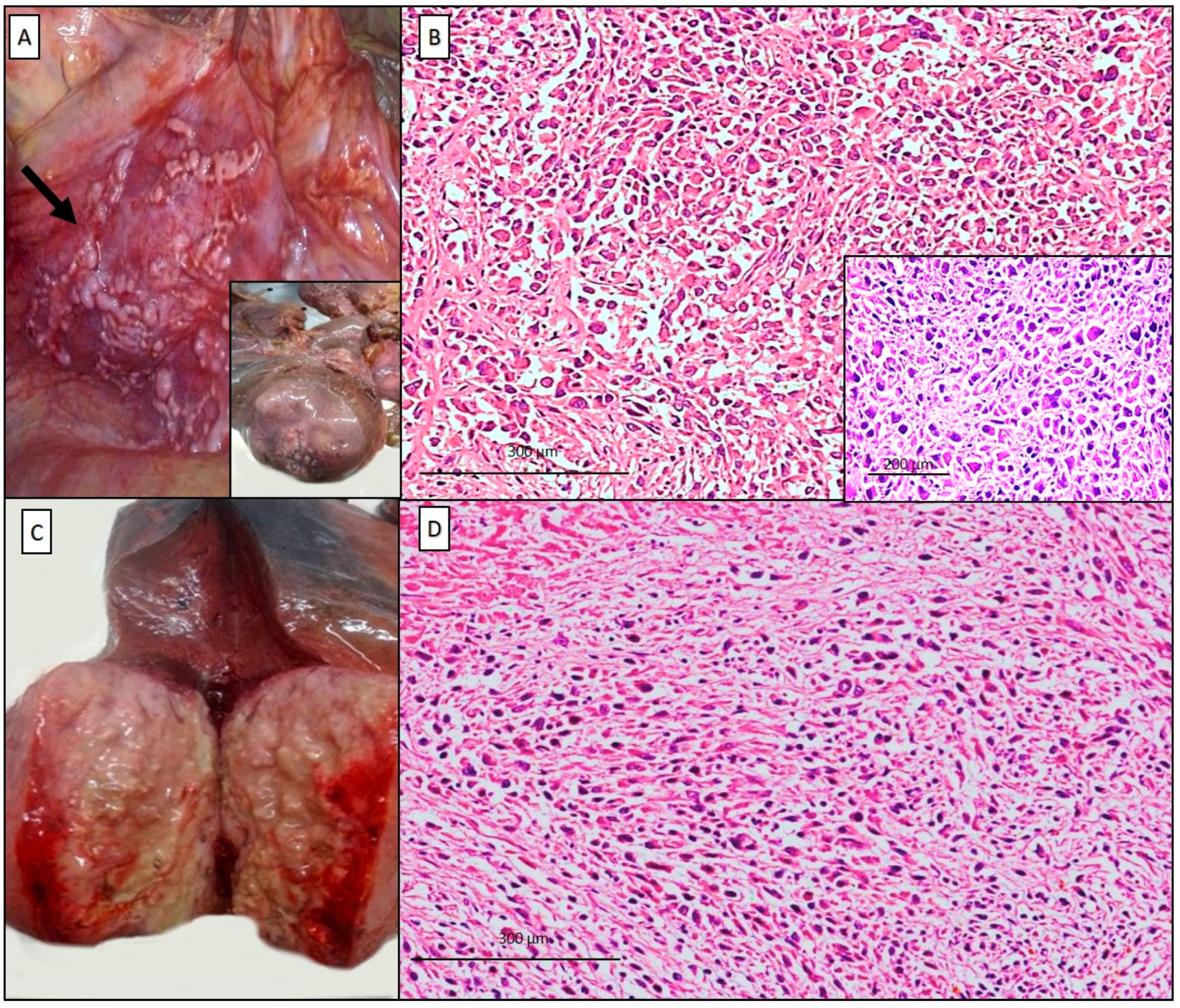 cancer research mesothelioma trials